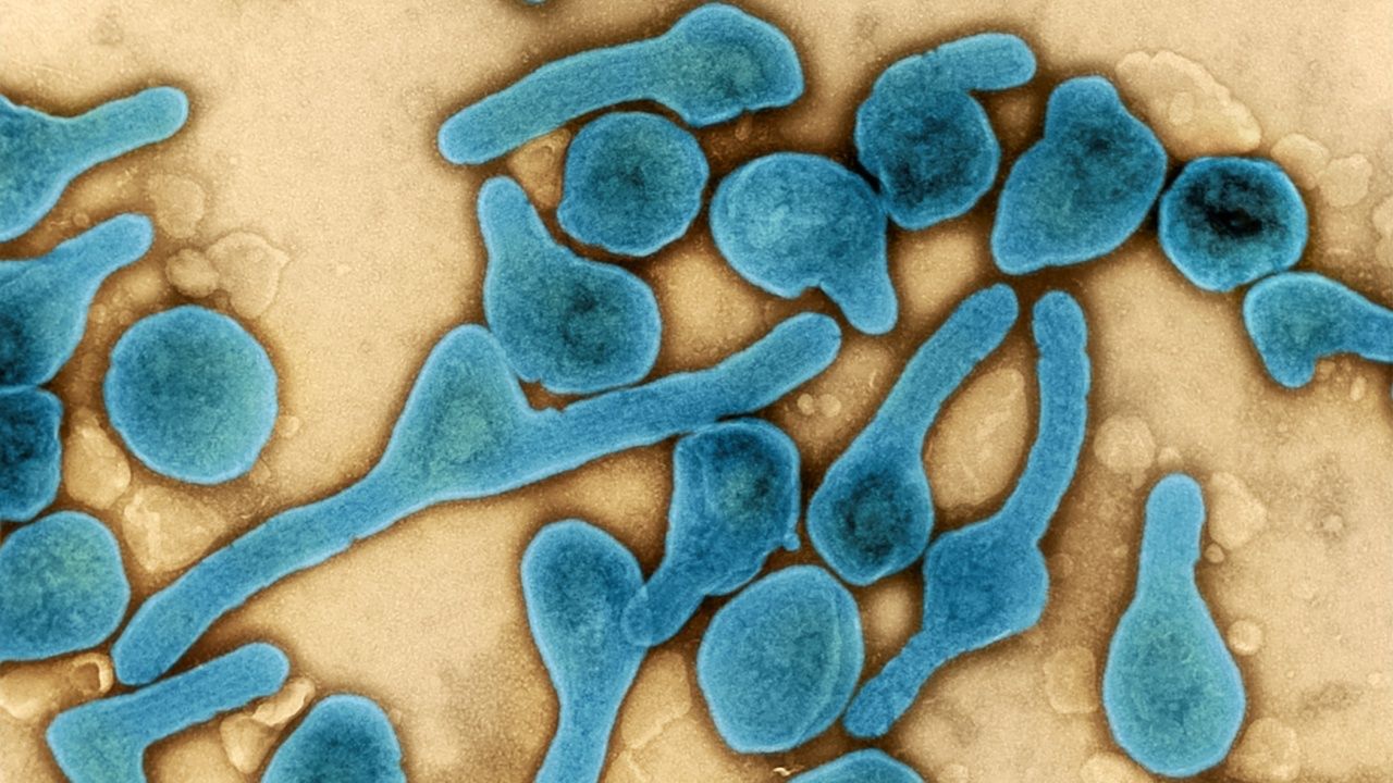 เชื้อไวรัสมาร์บวร์ก