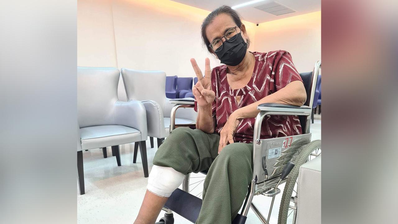 อย่าชะล่าใจ หนุ่มเตือนภัยแมวรักกัดขาแม่ 8 วันแผลไม่หาย จนสุดท้ายต้องผ่าตัด