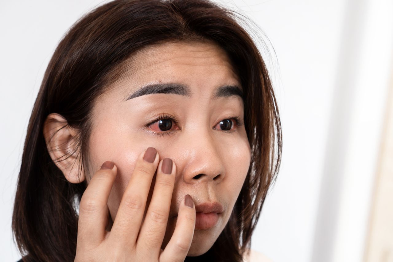 ภาพจาก iStock