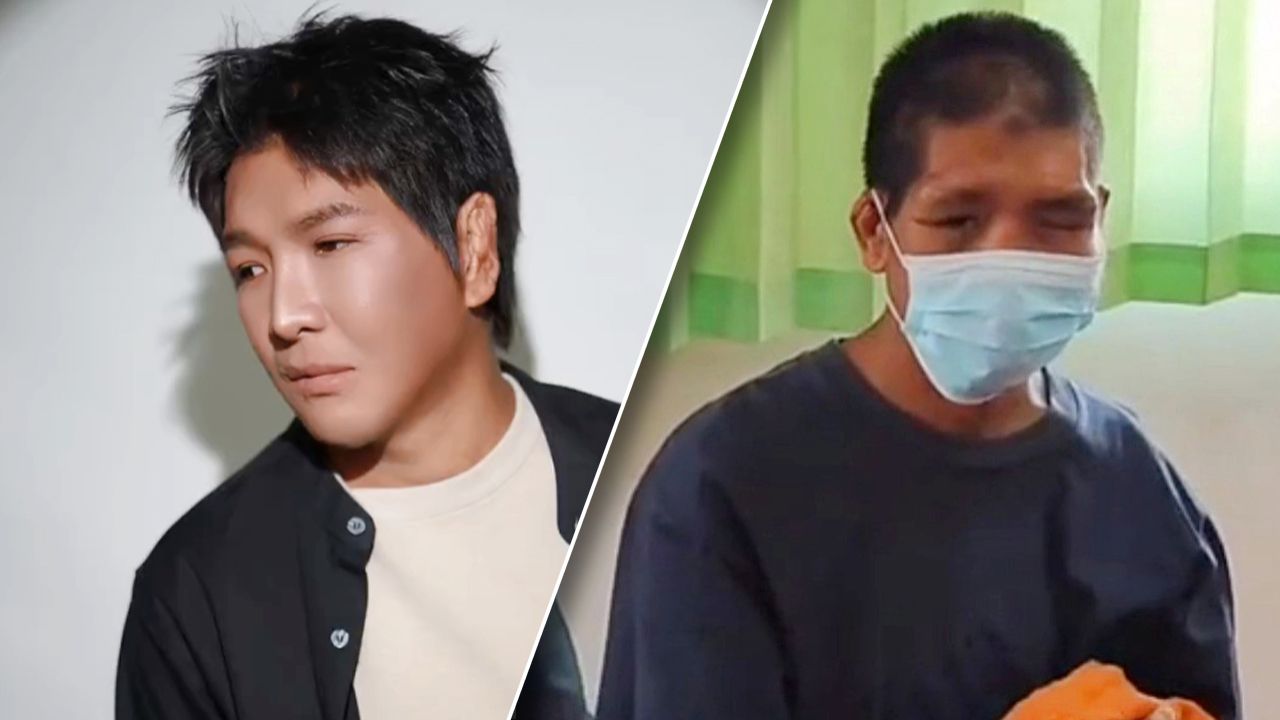 เผยโฉมใหม่ 'น้องฟ้า' หลังผ่านการผ่าตัดศัลยกรรม 4 ปี