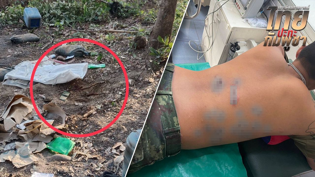 ทบ. แจง ทหารเหยียบทุ่นระเบิดเป็นของเก่าตกค้าง ขาซ้ายขาด-เจ็บ 3 นาย เร่งส่งตัวรักษาแล้ว