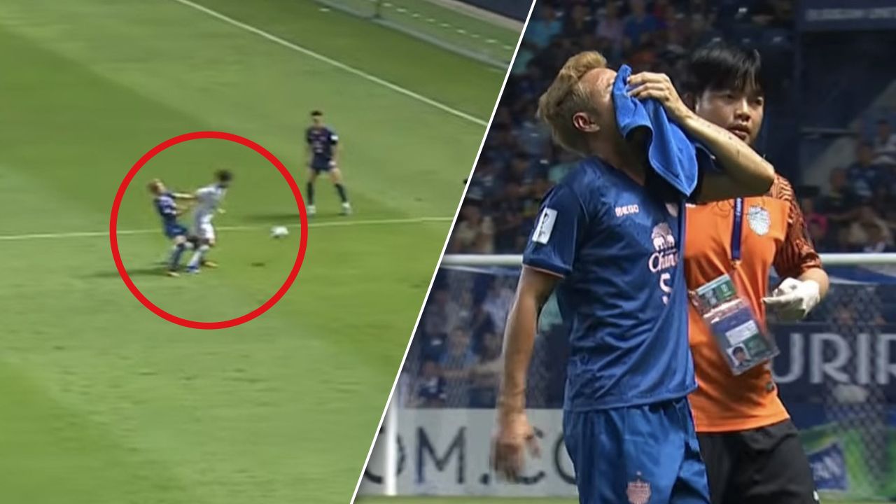 เปิดอาการล่าสุด "ธีราทร" หลังโดน "นักเตะทีมจีน" ปะทะหนักบริเวณจมูก (คลิป)