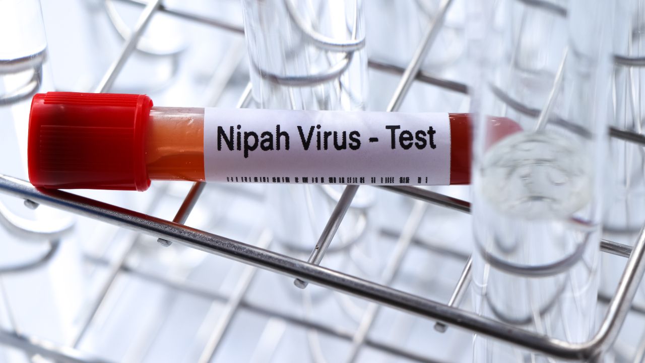 ความจริงเกี่ยวกับไวรัสนิปาห์ ไม่ใช่โรคใหม่ แพร่ในวงแคบ