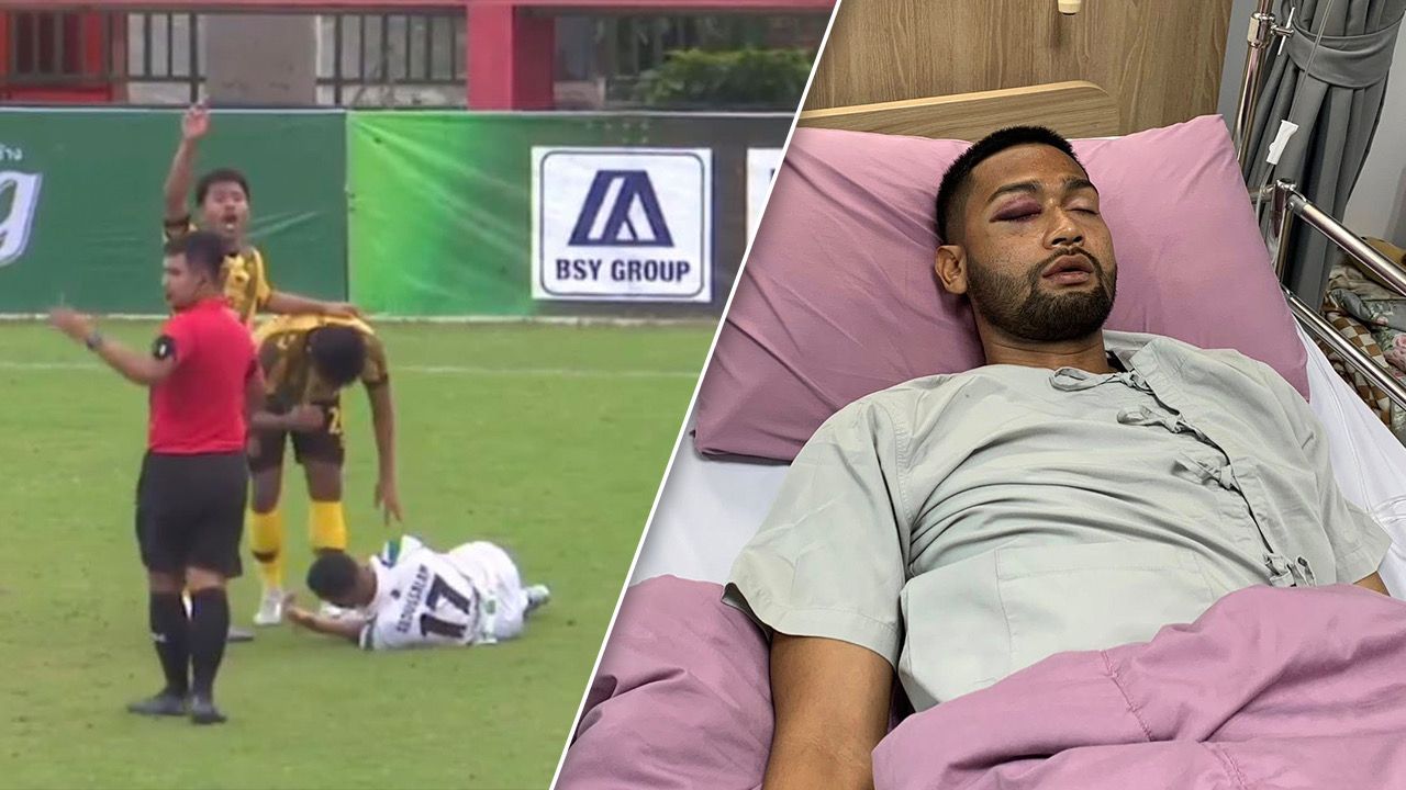 "นักฟุตบอลไทย" เข้าปะทะ "คู่แข่ง" กระดูกใบหน้าหัก 2 ข้าง