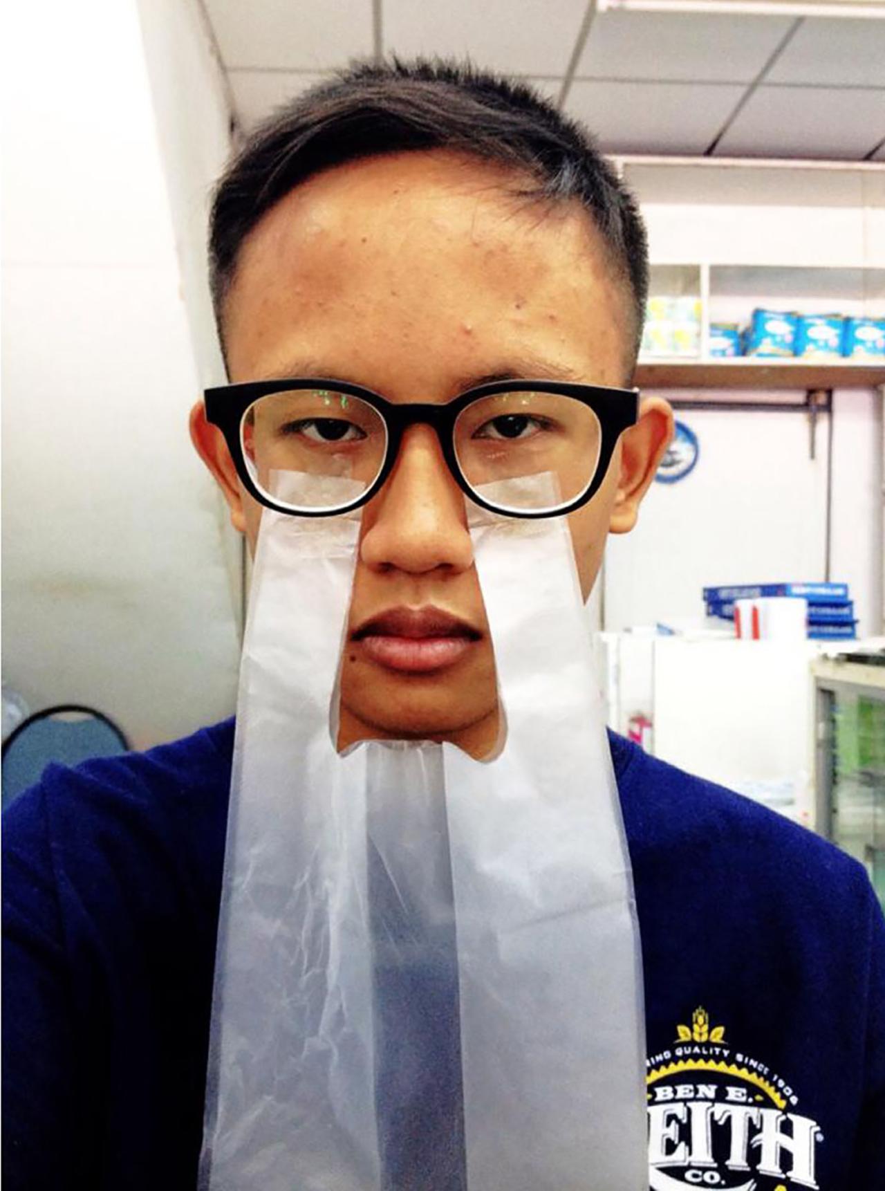 ผมเป็นคนมีถุงใต้ตาครับ