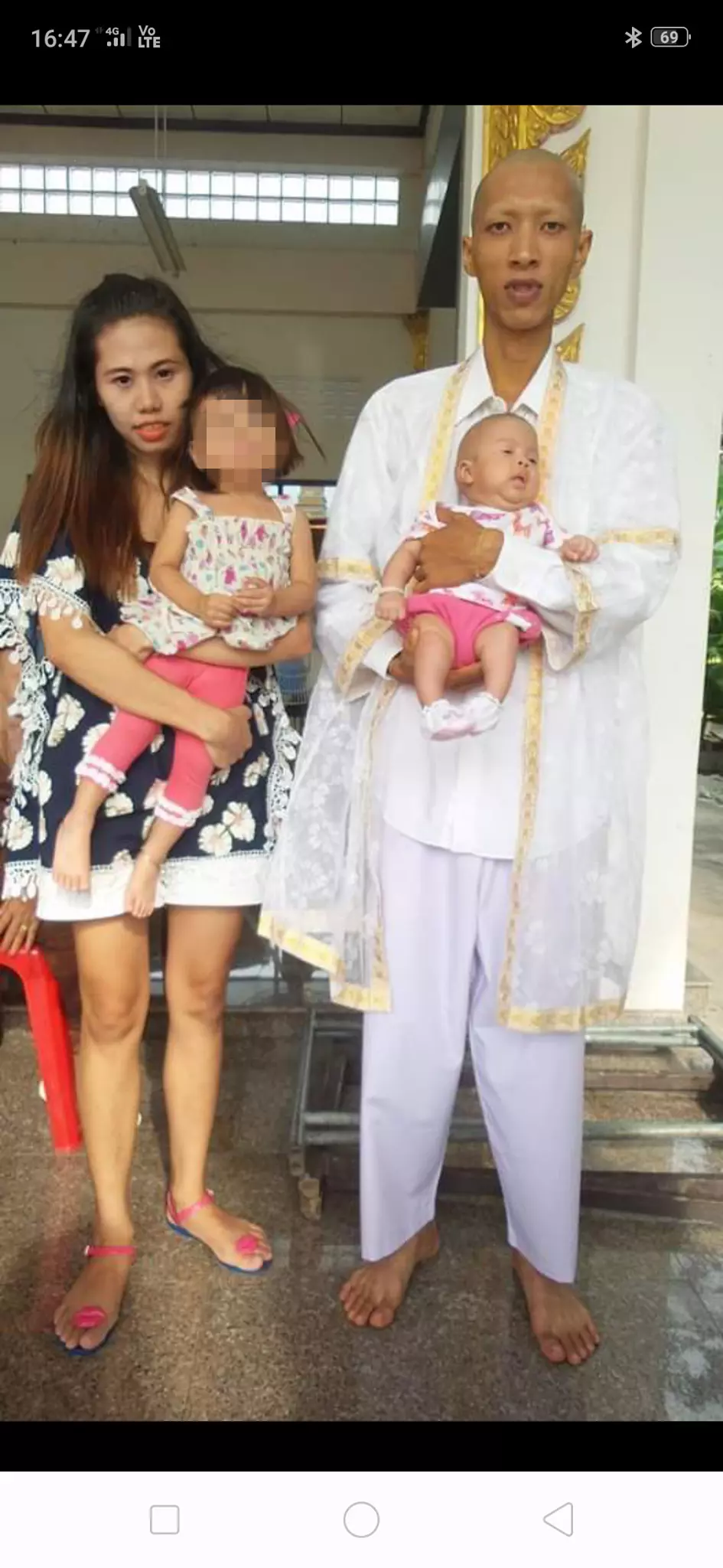 5 ขวบเดินได้ 2 ก้าว ป่วยโรคพบยากตั้งแต่ในท้องแม่ ระดมหมอนับสิบรักษา