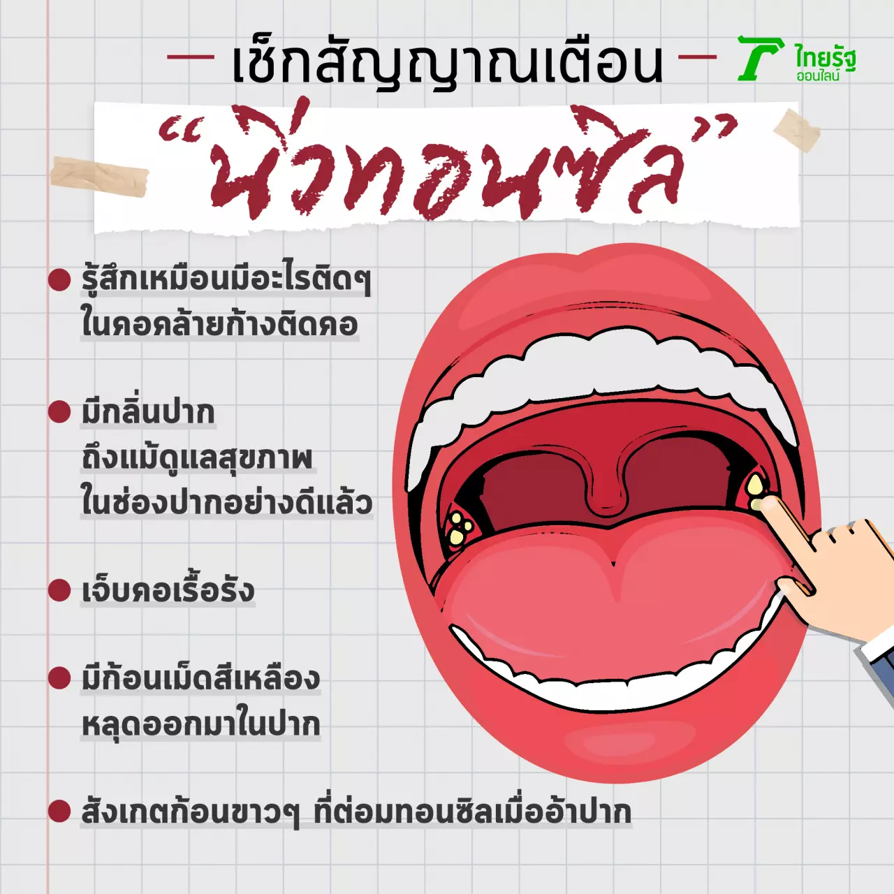 ก้อนสีเหลือง เหม็นเน่า ทำปากเหม็น เช็กลำคอ สัญญาณเตือน "นิ่วทอนซิล"