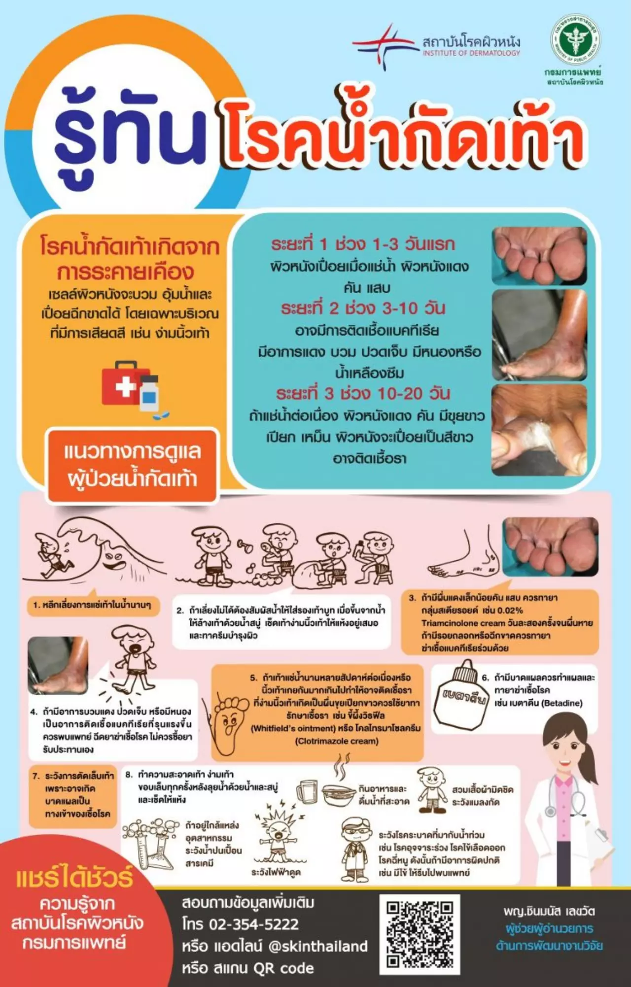 โรคน้ำกัดเท้า พบบ่อยช่วงหน้าฝน อาการหนักขั้นติดเชื้อ แนะวิธีการดูแล