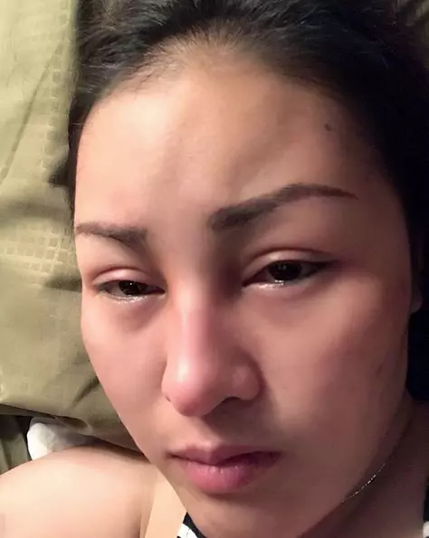 หญิงลี ร้องไห้ตาบวม สงสารตัวเองหลังป่วยหนักเกือบตาย
