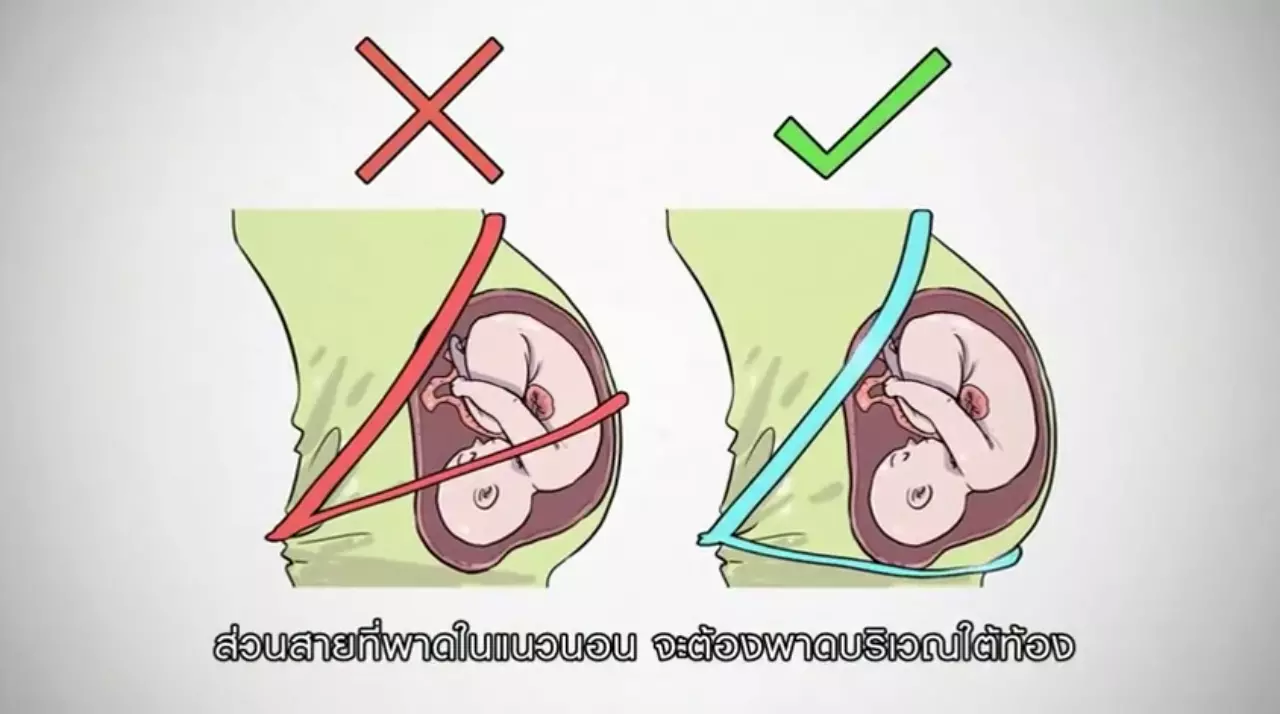 ใครผิดใครถูก? สามีโวยตำรวจ หลังเมียท้องแก่โดนจับไม่คาดเข็มขัดนิรภัย