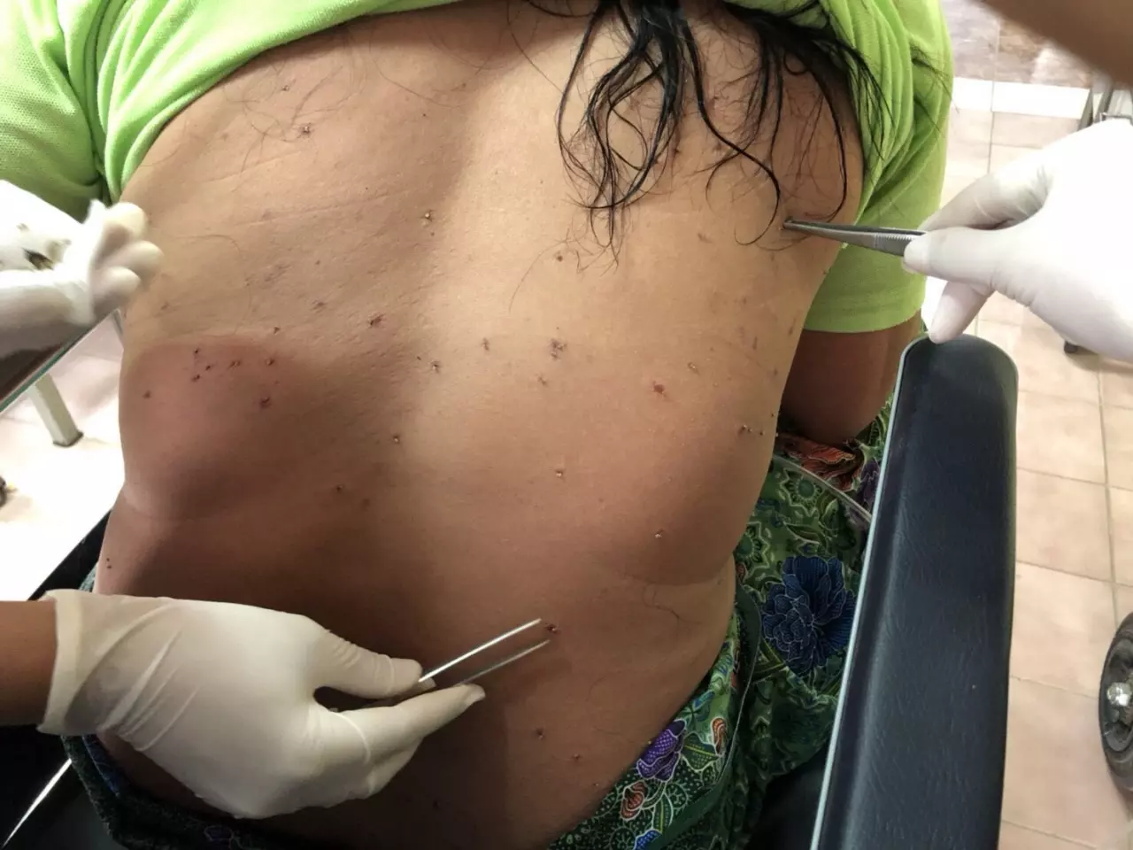ผัวเมียหวิดดับ! ผึ้งหลวงนับพันรุมต่อย เร่งดึงเหล็กในออก ให้ออกซิเจน
