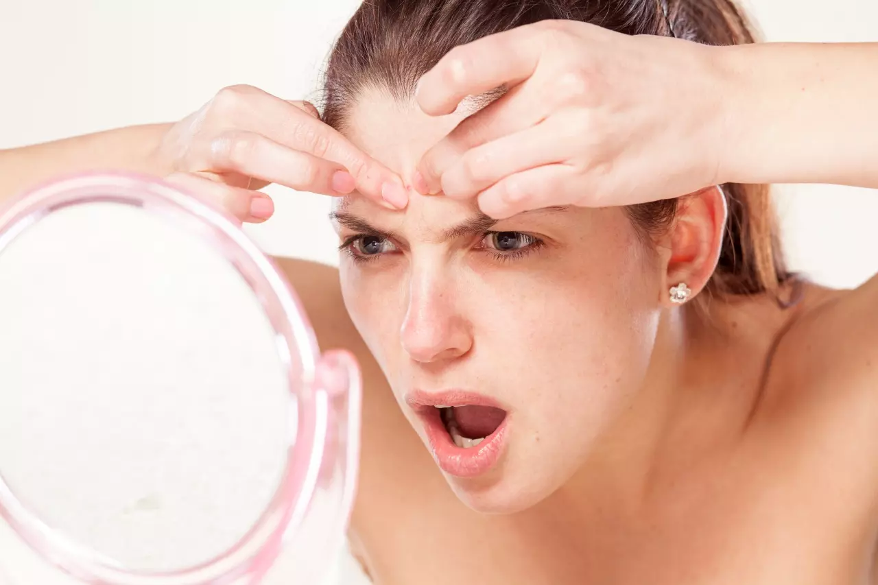 9 สาเหตุเกิดสิว 'นอนดึก' ทำให้ 'สิว' ขึ้นเยอะจริงหรือไม่?