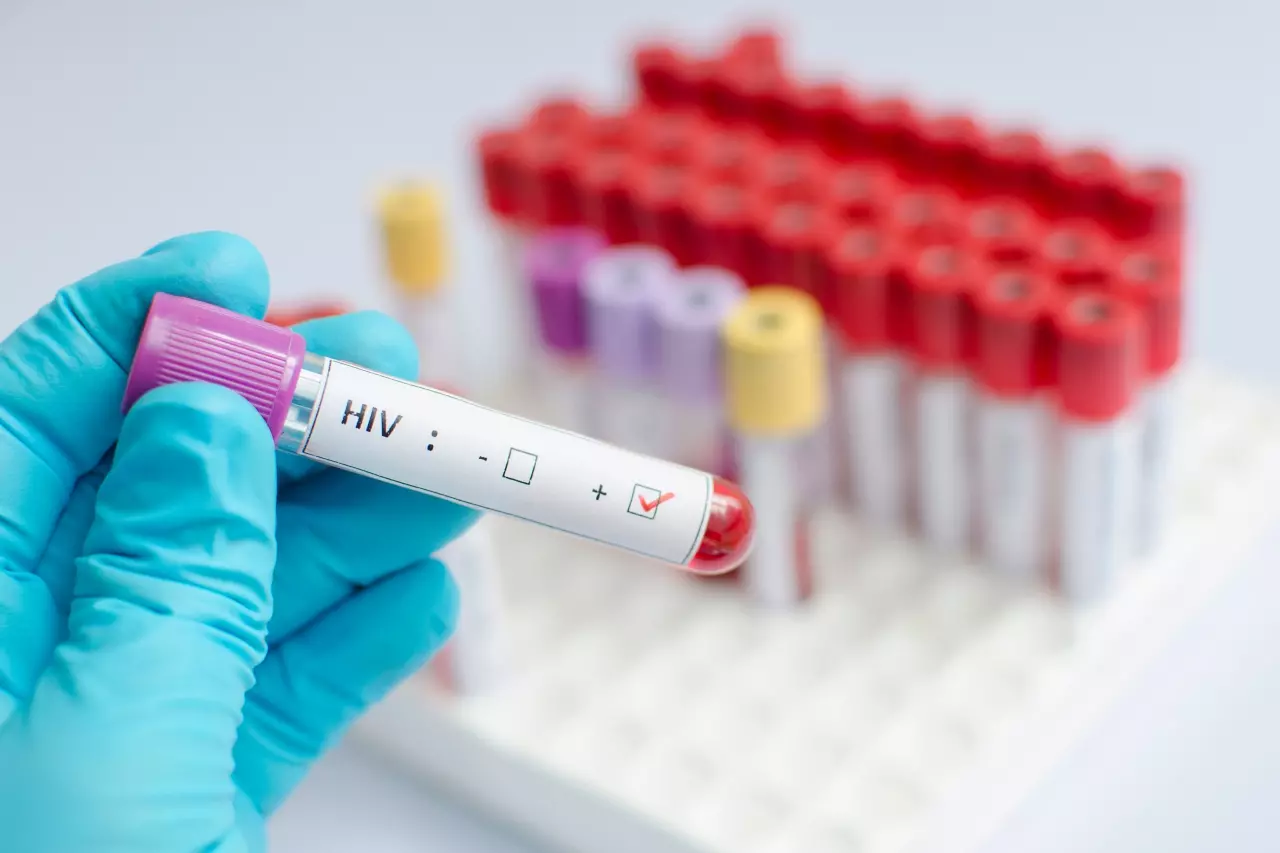 เปิดคัมภีร์ "PrEP-PEP" ไม่สวม "ถุงยาง" กันเชื้อ HIV แต่โรคติดต่อถามหา