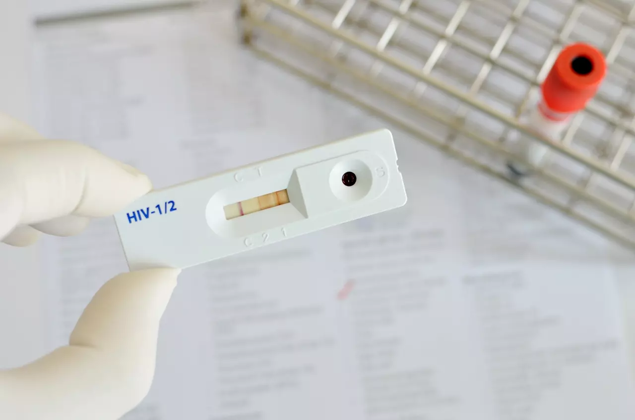 เปิดคัมภีร์ "PrEP-PEP" ไม่สวม "ถุงยาง" กันเชื้อ HIV แต่โรคติดต่อถามหา