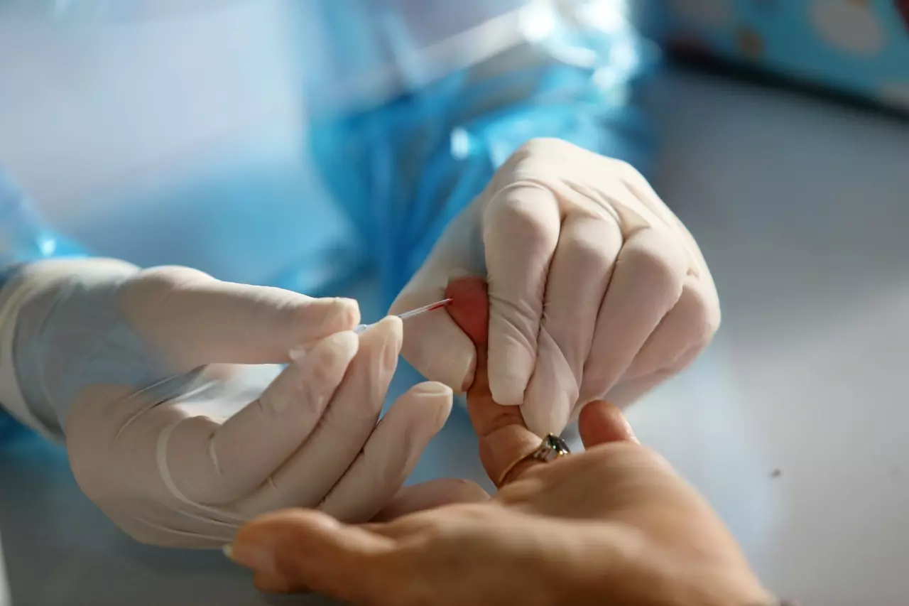 "Rapid Antigen Test" ทางเลือก คัดกรองโควิด ช่วงแพร่กระจาย ใช้ง่าย รู้ผลเร็ว