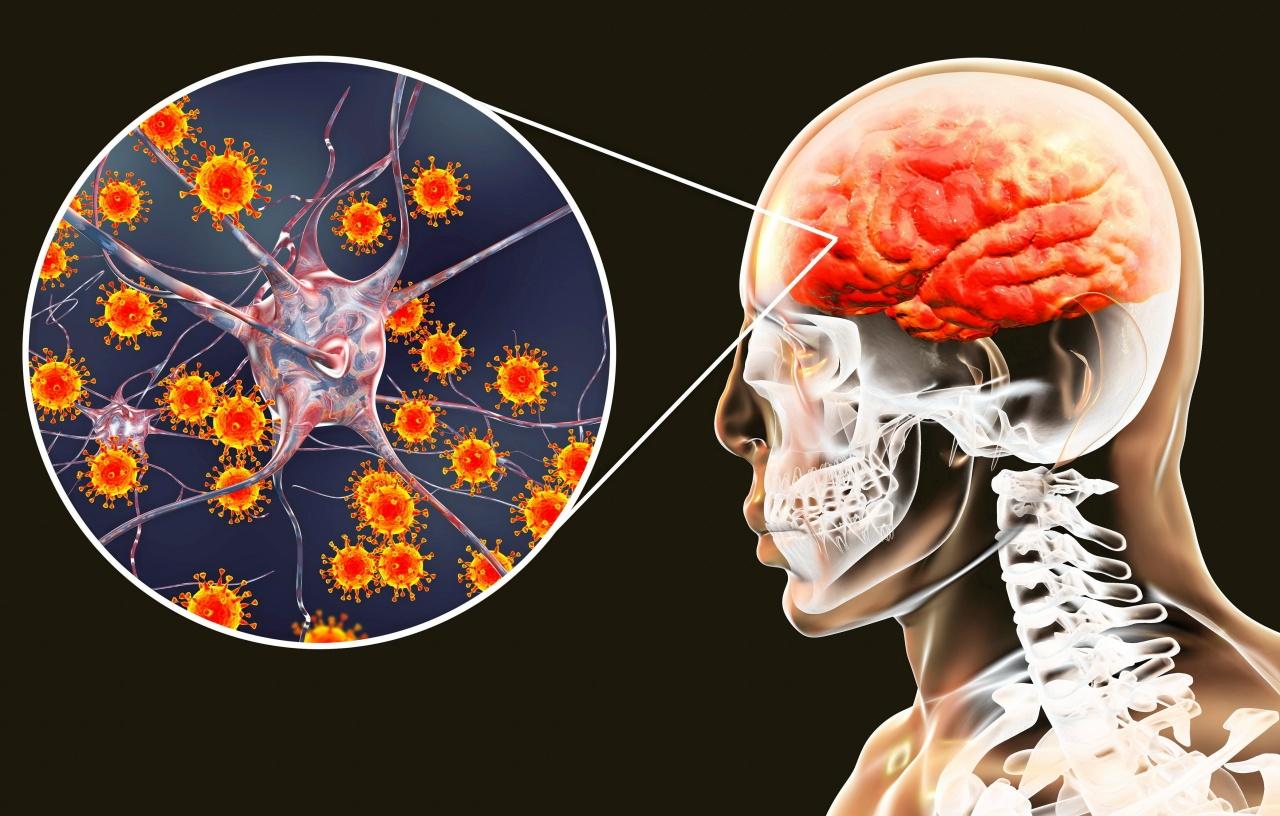 Long covid causes abnormalities to the brain.  memory  analytical thinking 