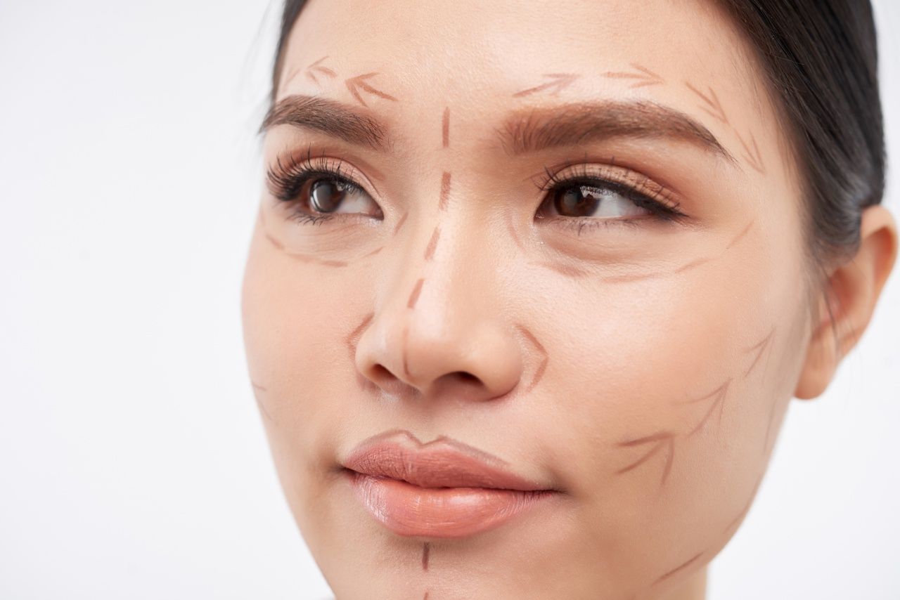 Endotine brow lift surgery helps to solve the problem of drooping eyelids and also solves the problem of sagging and wrinkles in the forehead area (Image from iStock).