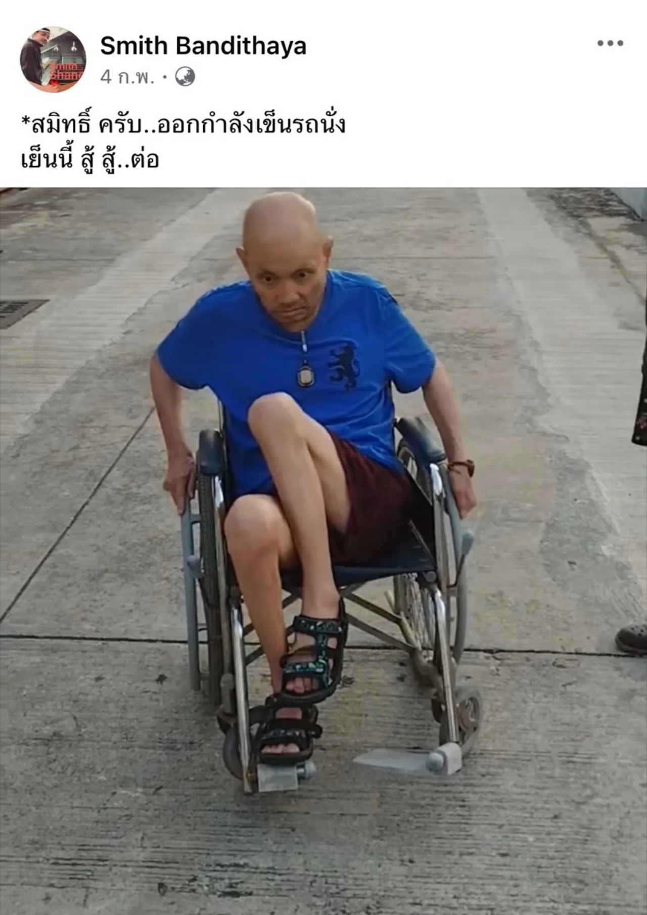 อดีตนักร้อง สมิทธิ์ วงสมิธแอนด์เชน ป่วยหนักเป็นอัมพฤกษ์ คนส่งกำลังใจจำนวนมาก 