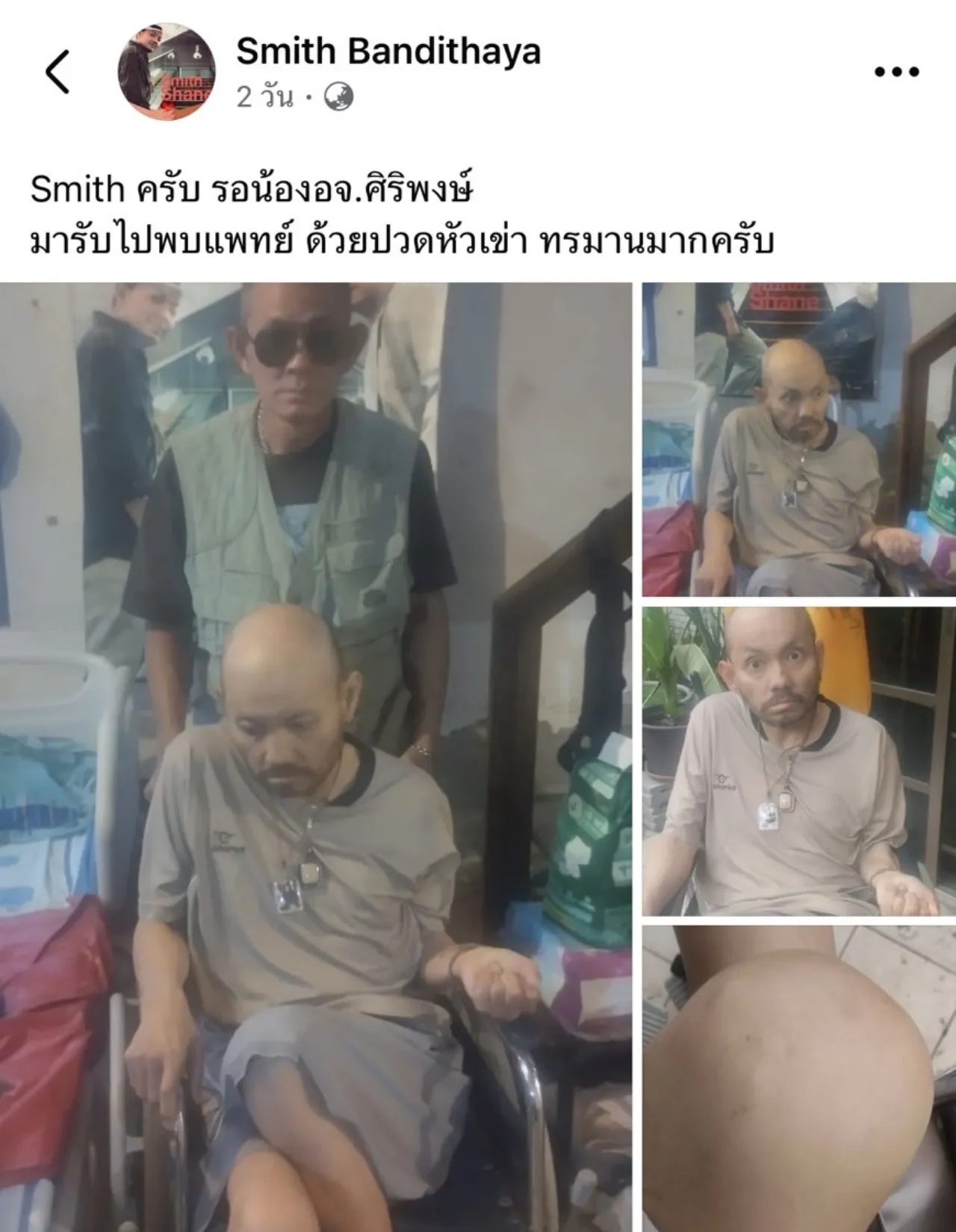 อดีตนักร้อง สมิทธิ์ วงสมิธแอนด์เชน ป่วยหนักเป็นอัมพฤกษ์ คนส่งกำลังใจจำนวนมาก 