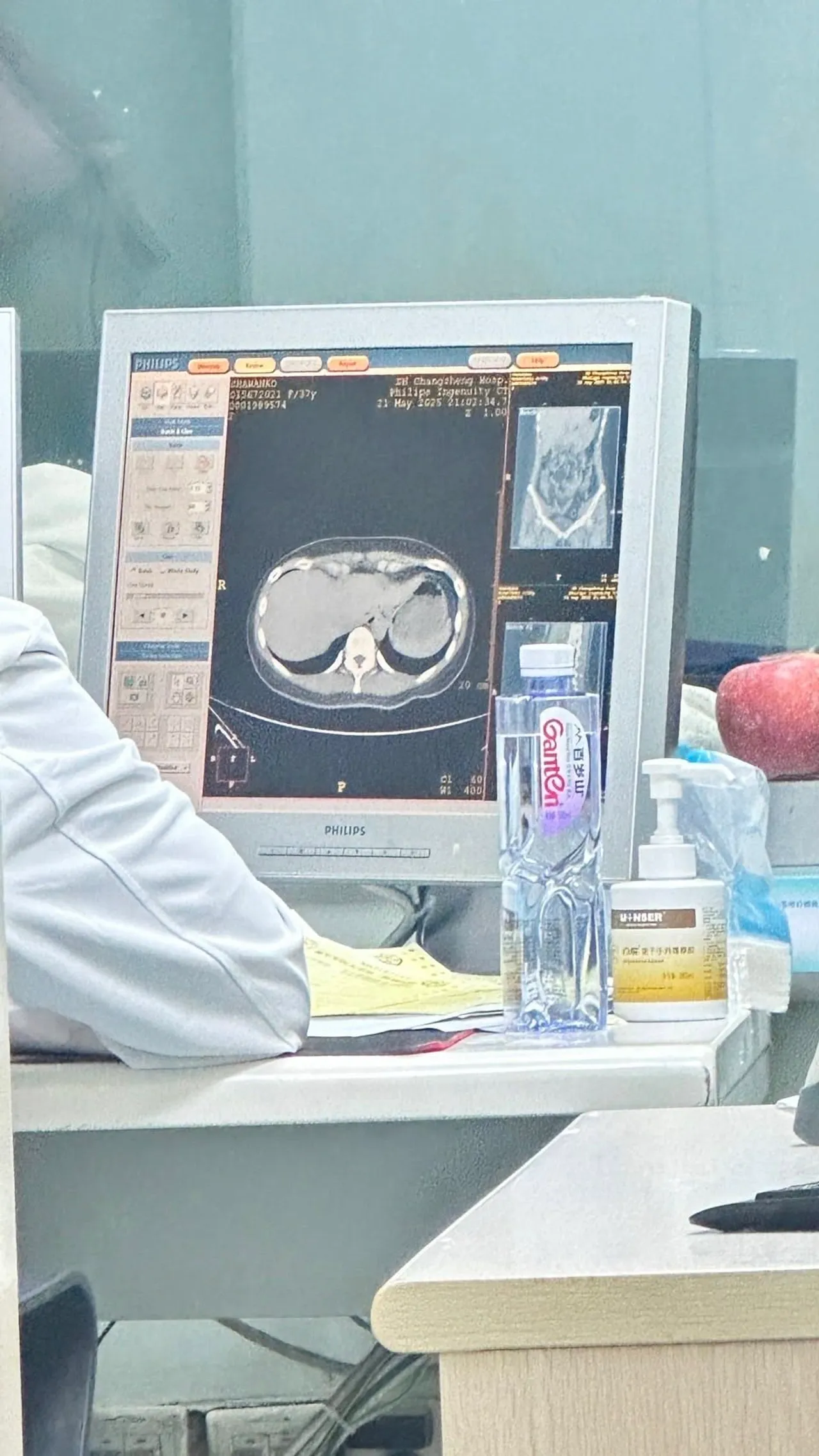 กระติ๊บ ชวัลกร ปวดท้องหนักถูกพาส่งโรงพยาบาลที่จีน เจอยอดค่ารักษา ถูกจนช็อก