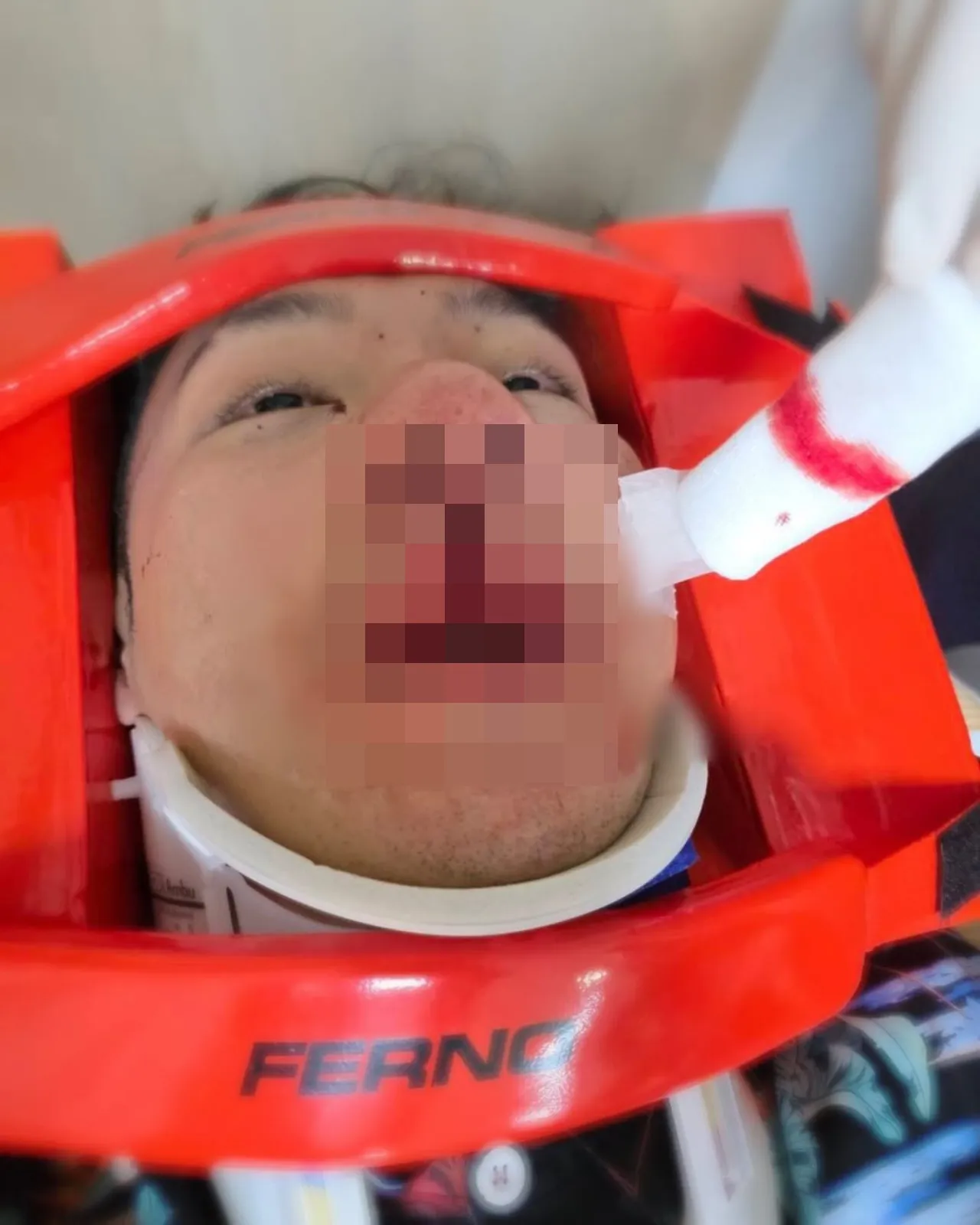 เผยภาพ ตั้ม วราวุธ ตอนประสบอุบัติเหตุ ตุ๊กกี้ เผยรายชื่อห้ามเยี่ยม