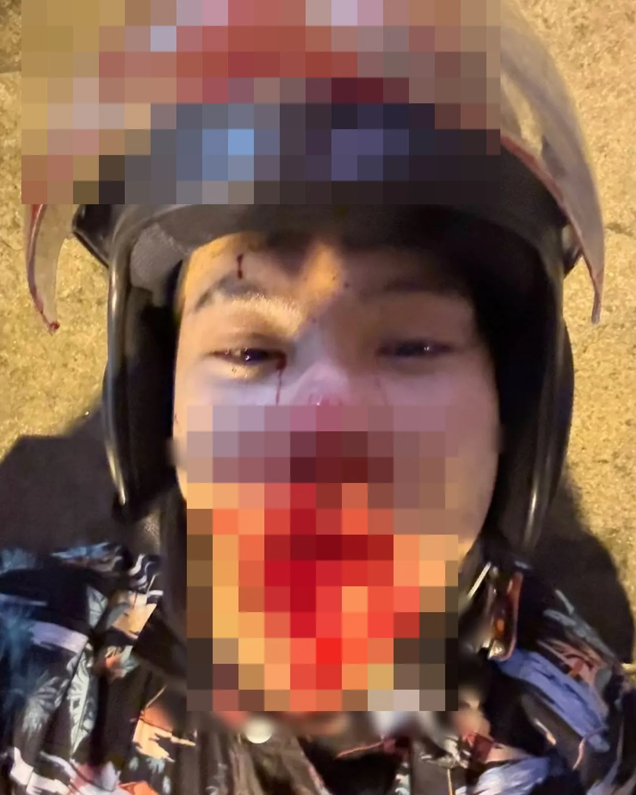 เผยภาพ ตั้ม วราวุธ ตอนประสบอุบัติเหตุ ตุ๊กกี้ เผยรายชื่อห้ามเยี่ยม