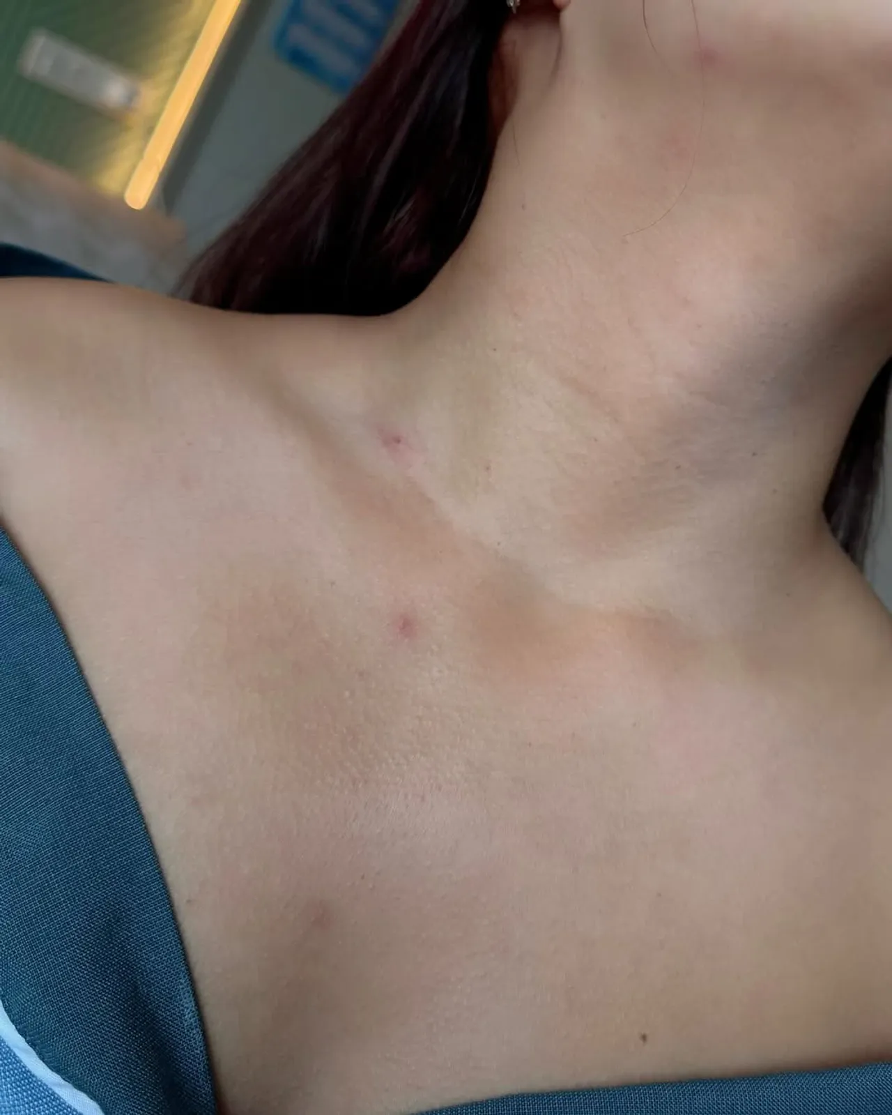 ลิลลี่ ได้หมดถ้าสดชื่น แอดมิทดูอาการเกือบ 2 อาทิตย์ ขอโทษเจ้าภาพที่ไปทำงานไม่ได้