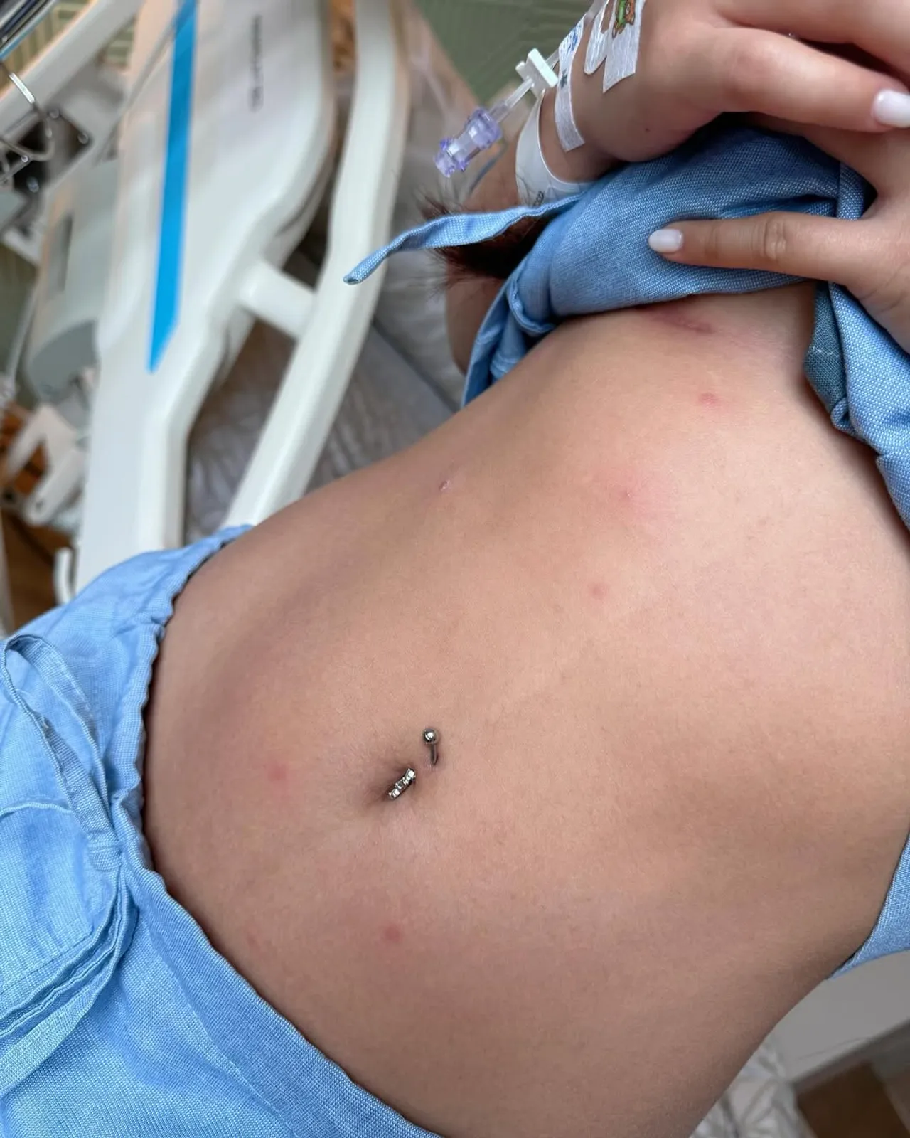 ลิลลี่ ได้หมดถ้าสดชื่น แอดมิทดูอาการเกือบ 2 อาทิตย์ ขอโทษเจ้าภาพที่ไปทำงานไม่ได้