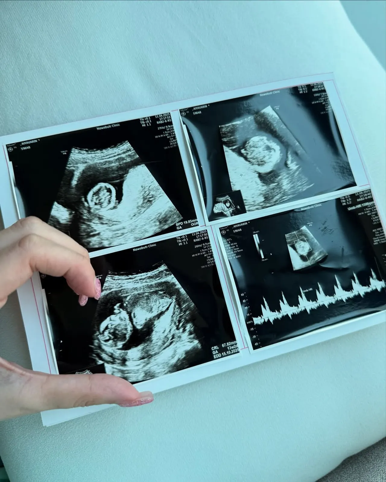 ทีเค เผยสาเหตุเลิก บีเบล โต้ไม่รับผิดชอบเรื่องลูก แต่ยังเจรจาไม่ลงตัว