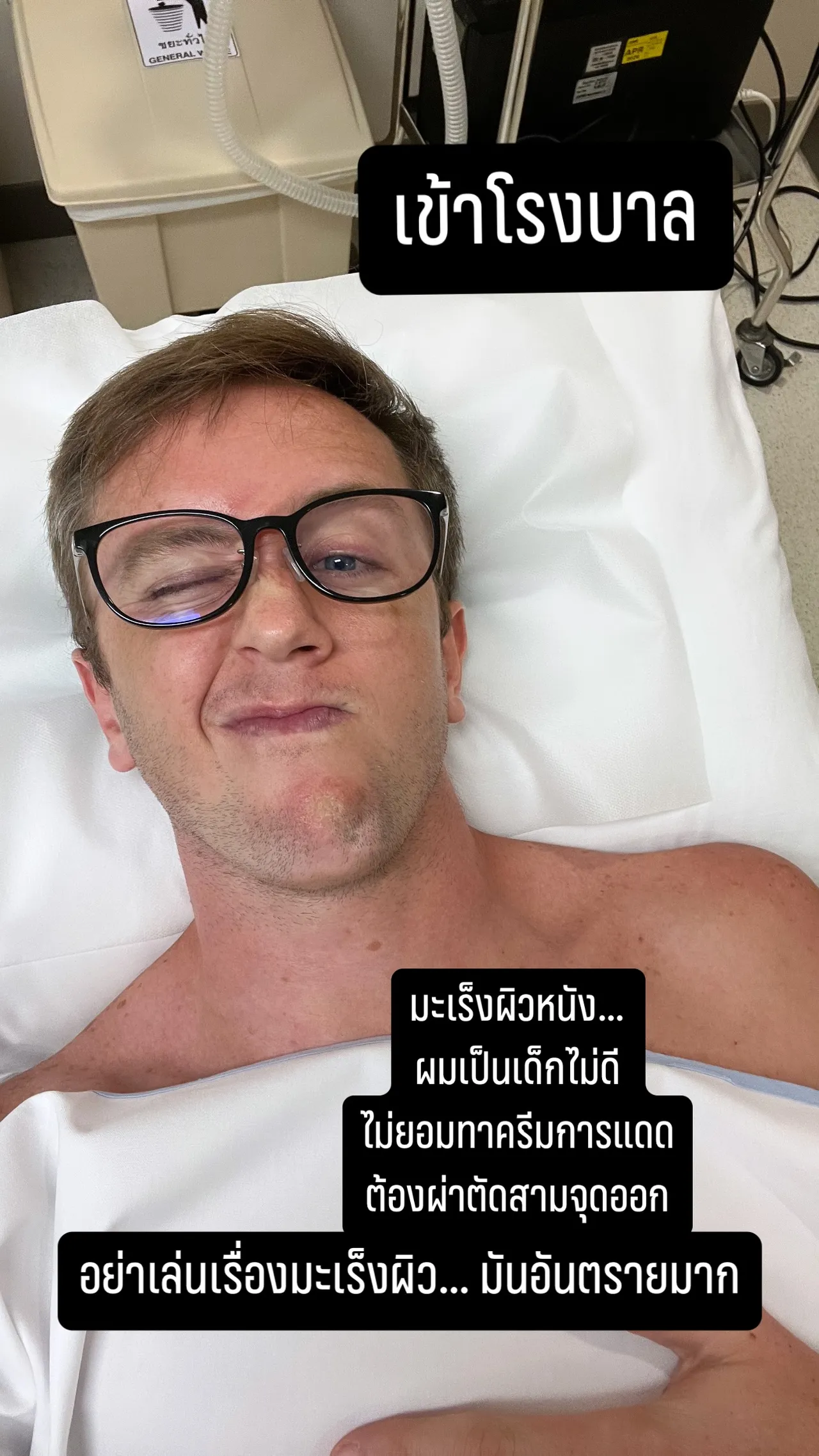 เนท My Mate Nate เตือนทุกคนให้ระวัง ต้องผ่าตัด 3 จุดเพราะไม่ชอบทาครีมกันแดด