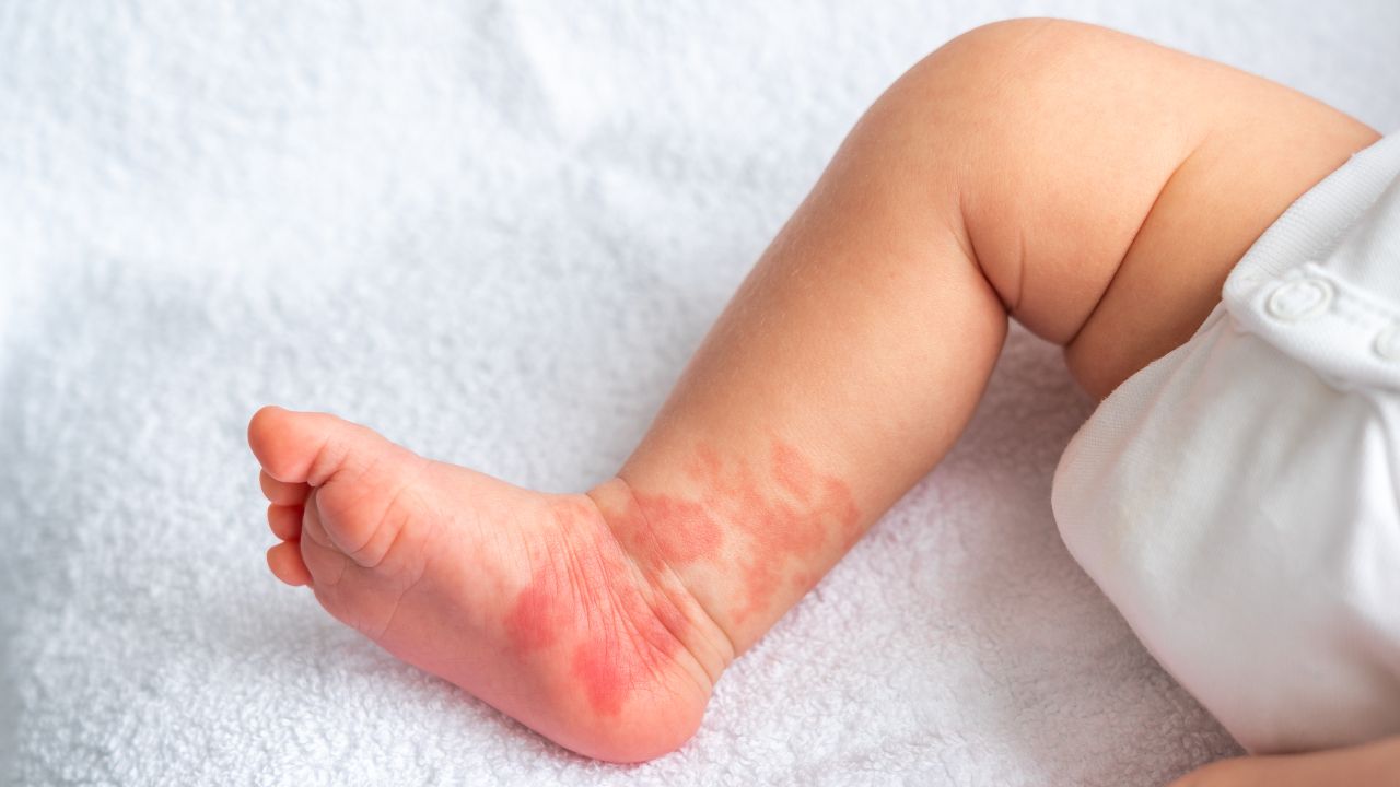 ภาพจาก iStock