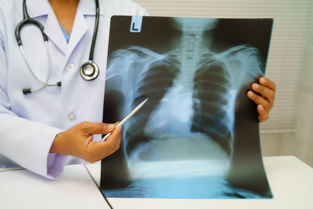 ภาพจาก iStock