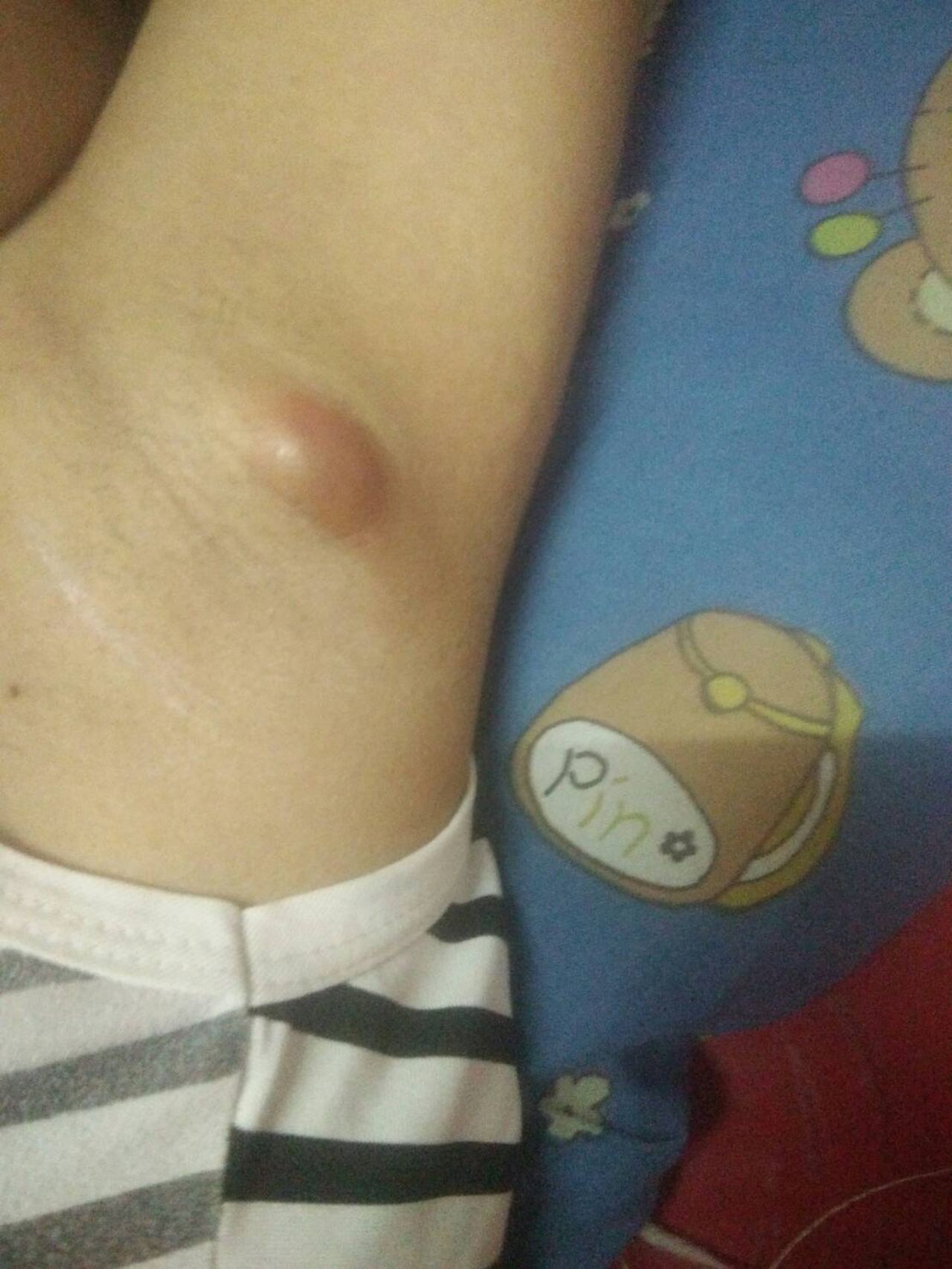 หลังจากใช้เซรั่ม ได้ 3 วัน 