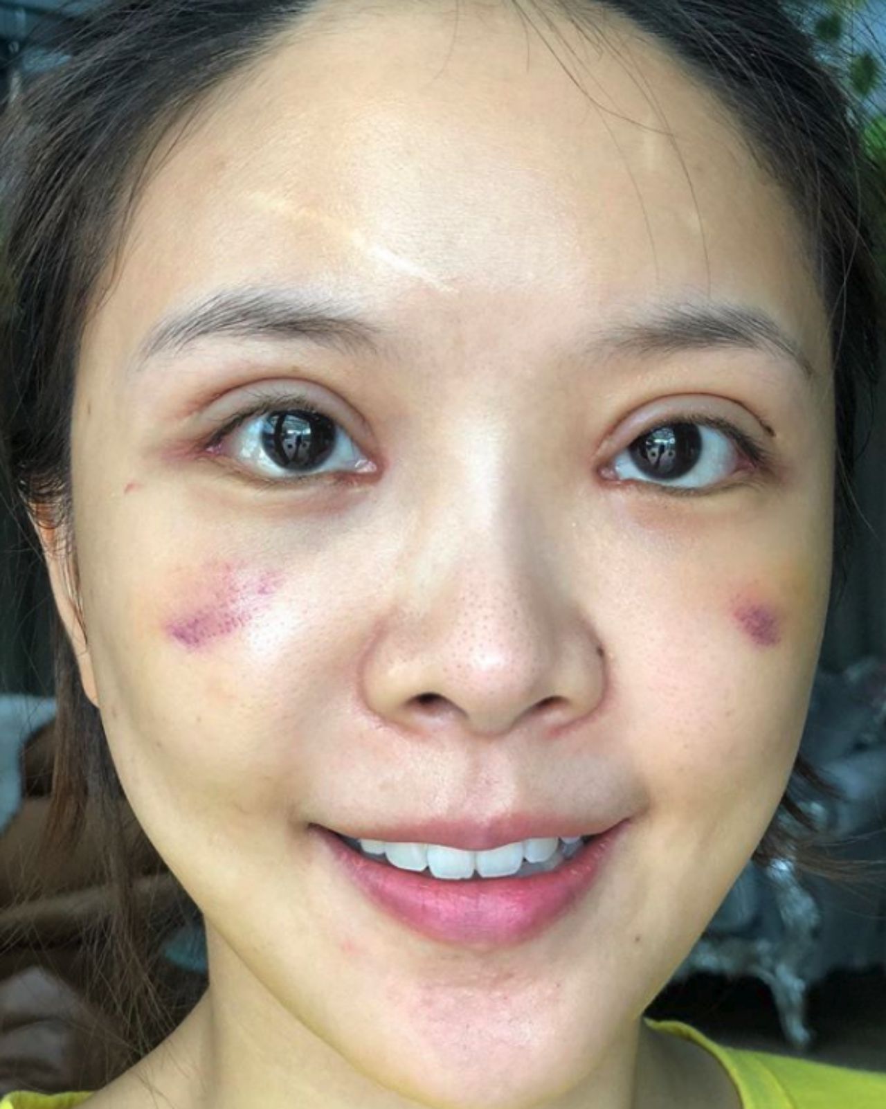 ผ่านไป 27 วัน แบบโนเมคอัพ