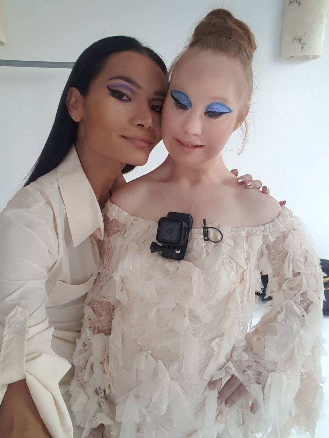 มีมี่ กับ นางแบบดาว์นซินโดรม