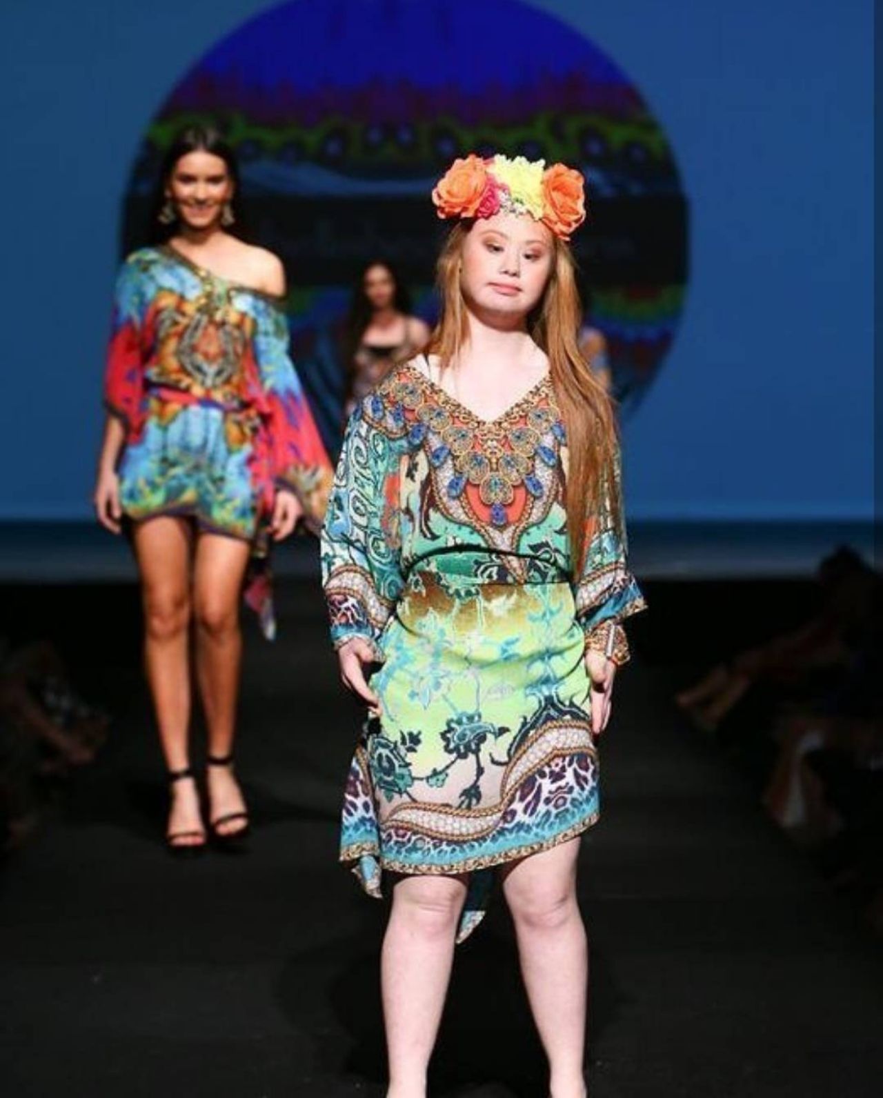 แจ่มทีเดียว นางแบบดาวน์ซินโดรม