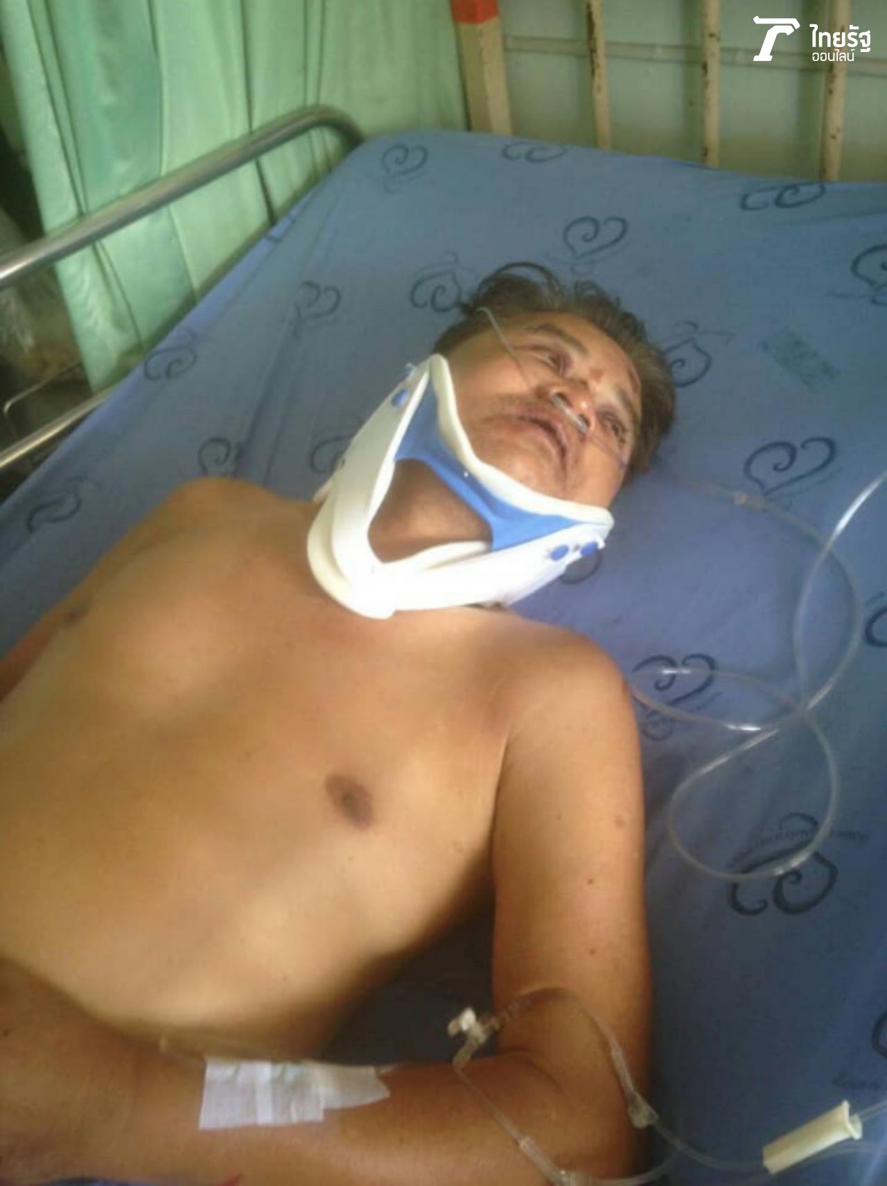 อาการพ่อเลี่ยมหลังประสบอุบัติเหตุ