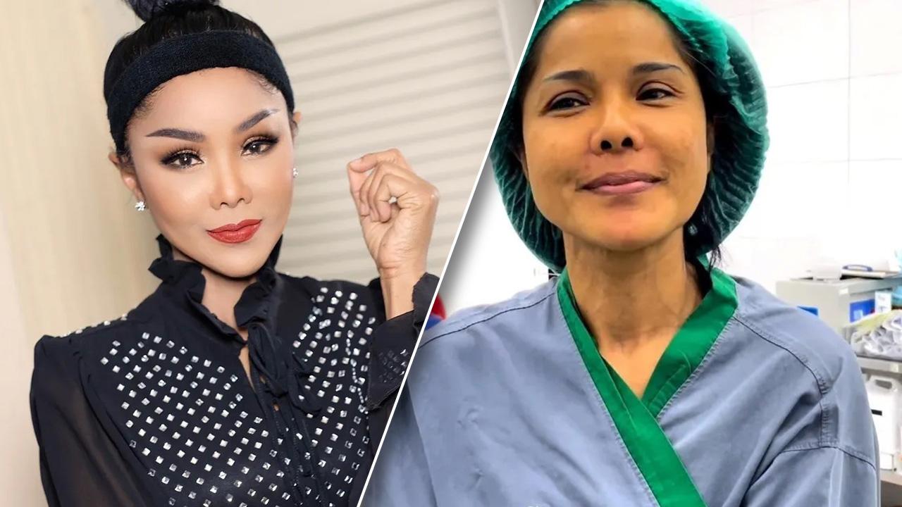 เจเน็ต เขียว เปิดหน้าหลังทำศัลยกรรมในวัย 54 ปี ดูเด็กลงกว่าเดิม
