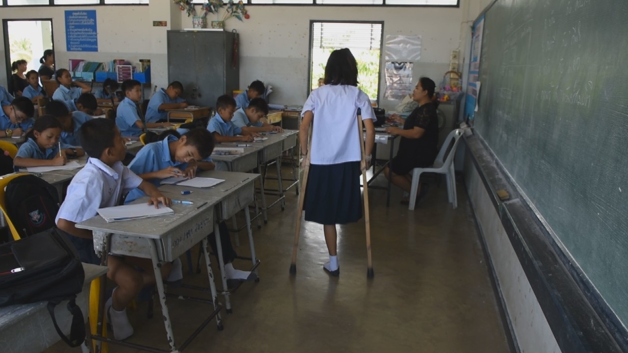 แสนสงสาร น้องวิ เด็กหญิงขาเดียวสู้ชีวิต พ่อตาย ตัวเองถูกรถชนจนพิการ  