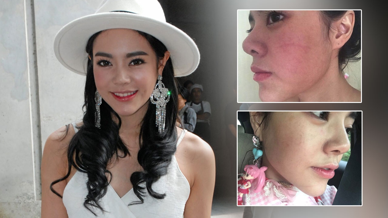 กัสจัง แม่พระสุดๆ โดนตำรวจตบไม่แจ้งความ บอกต้องรู้จักให้อภัย