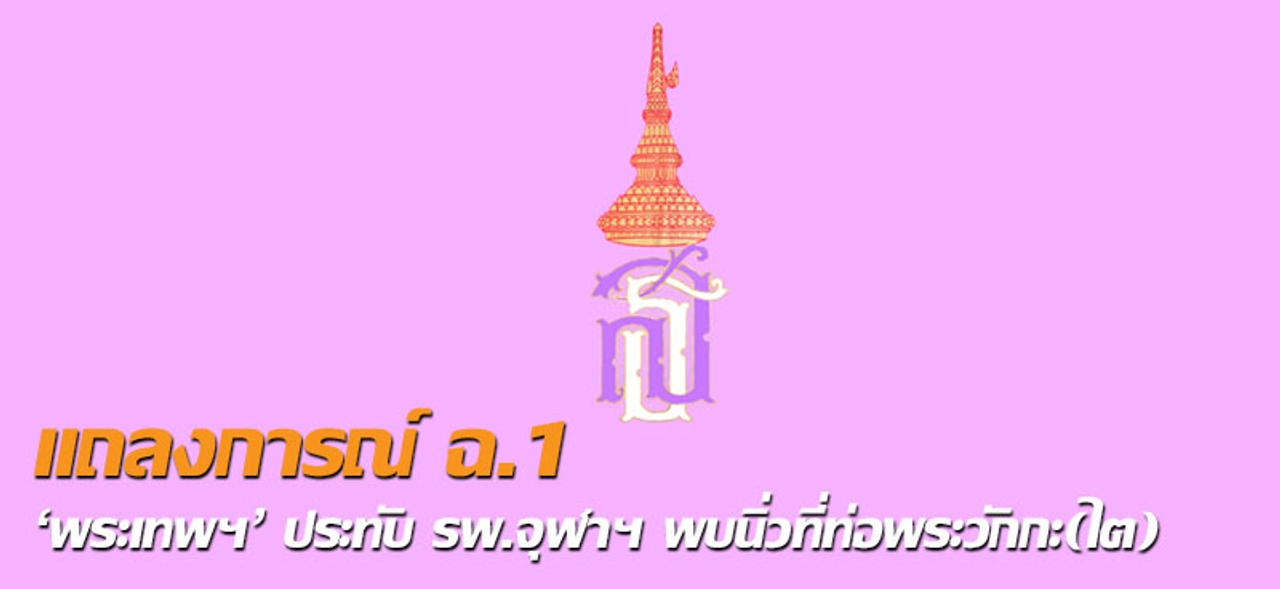 แถลงการณ์ ฉ.1 'พระเทพฯ'ประทับ รพ.จุฬาฯ พบนิ่วที่ท่อพระวักกะ(ไต) 