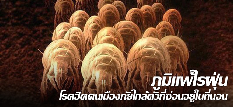 ภูมิแพ้ไรฝุ่น โรคฮิตคนเมืองภัยใกล้ตัวที่ซ่อนอยู่ในที่นอน