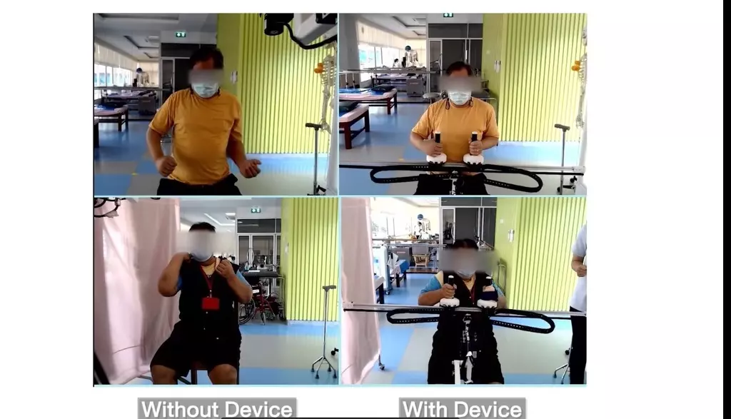 'Arm booster' นวัตกรรมเสริมพลังใจ กายภาพผู้ป่วยโรคหลอดเลือดสมอง
