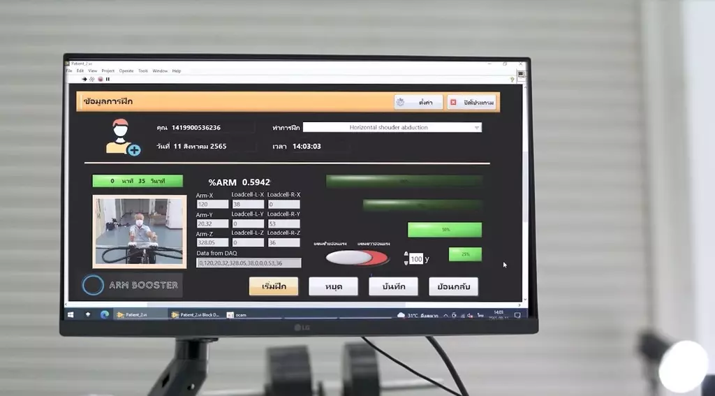 'Arm booster' นวัตกรรมเสริมพลังใจ กายภาพผู้ป่วยโรคหลอดเลือดสมอง