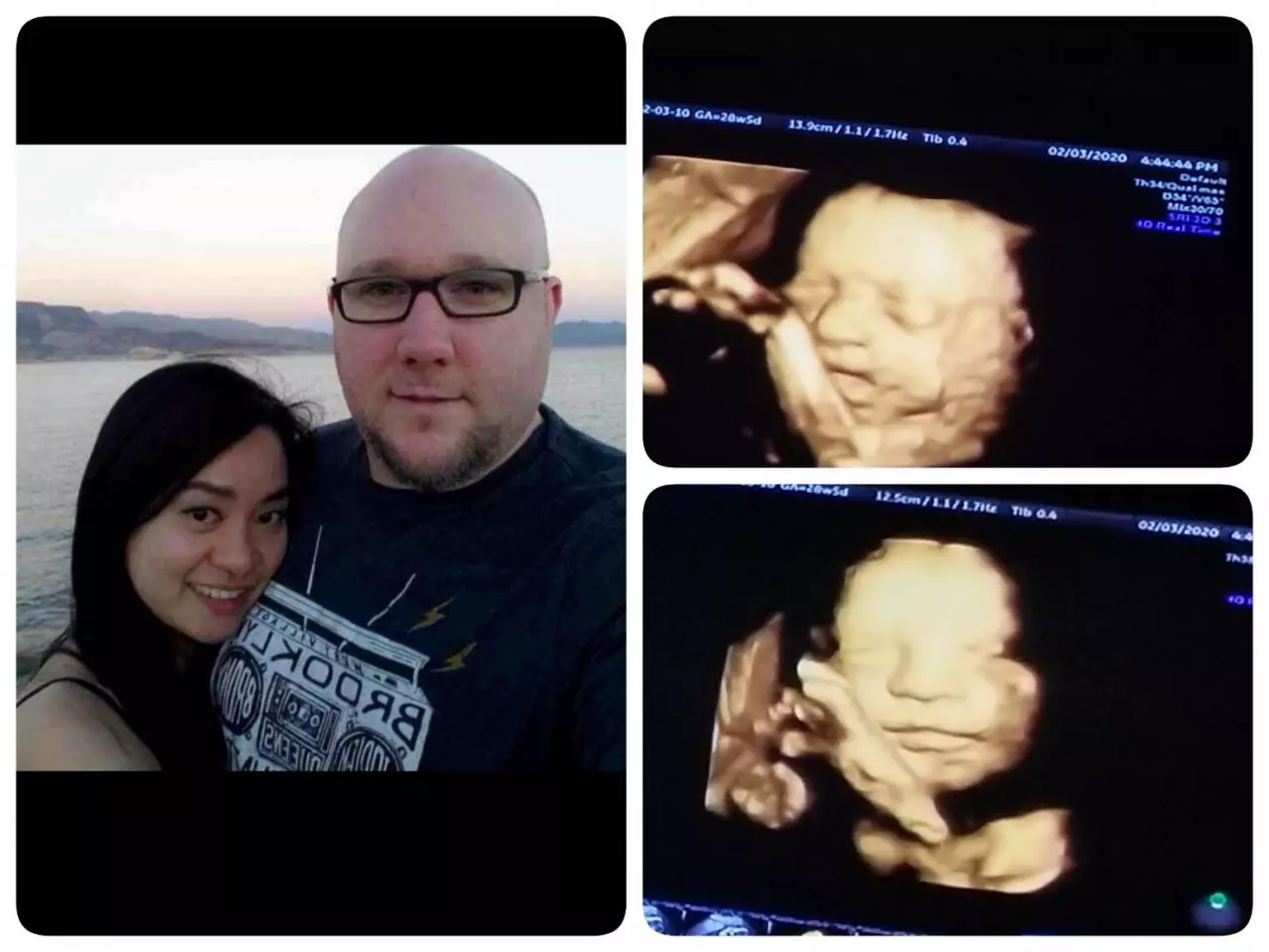 ไม่คิดมีลูก จู่ๆ มาเกิด แม่ใจเด็ด ปฏิเสธรักษา สู้มะเร็งระยะสุดท้าย ยื้อชีวิตลูก