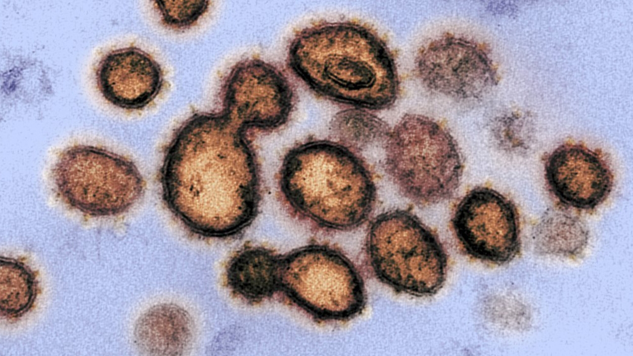 อังกฤษเผยผลการศึกษาครั้งใหญ่ พบผู้ชายตายจากโควิด สูงกว่าหญิงเกือบ 2 เท่า