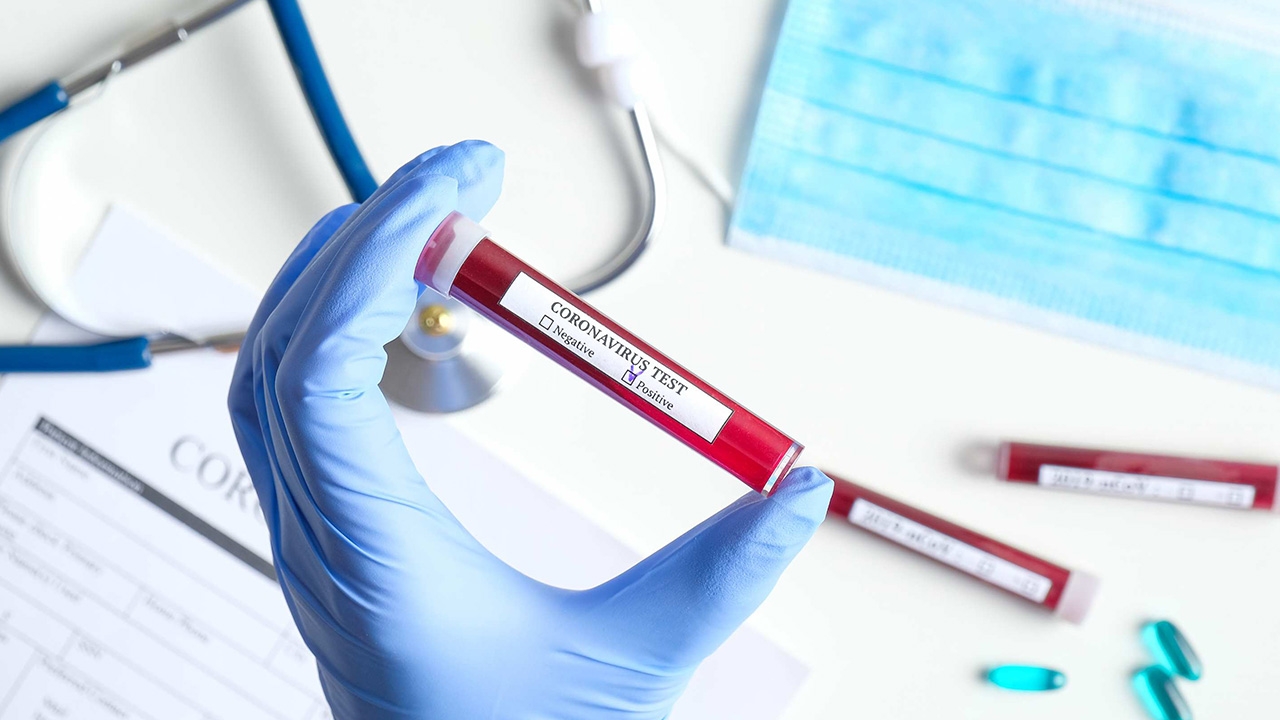 ม.สงขลานครินทร์ พัฒนาชุดตรวจโควิด-19 แค่ 15-20 นาทีก็ทราบผล