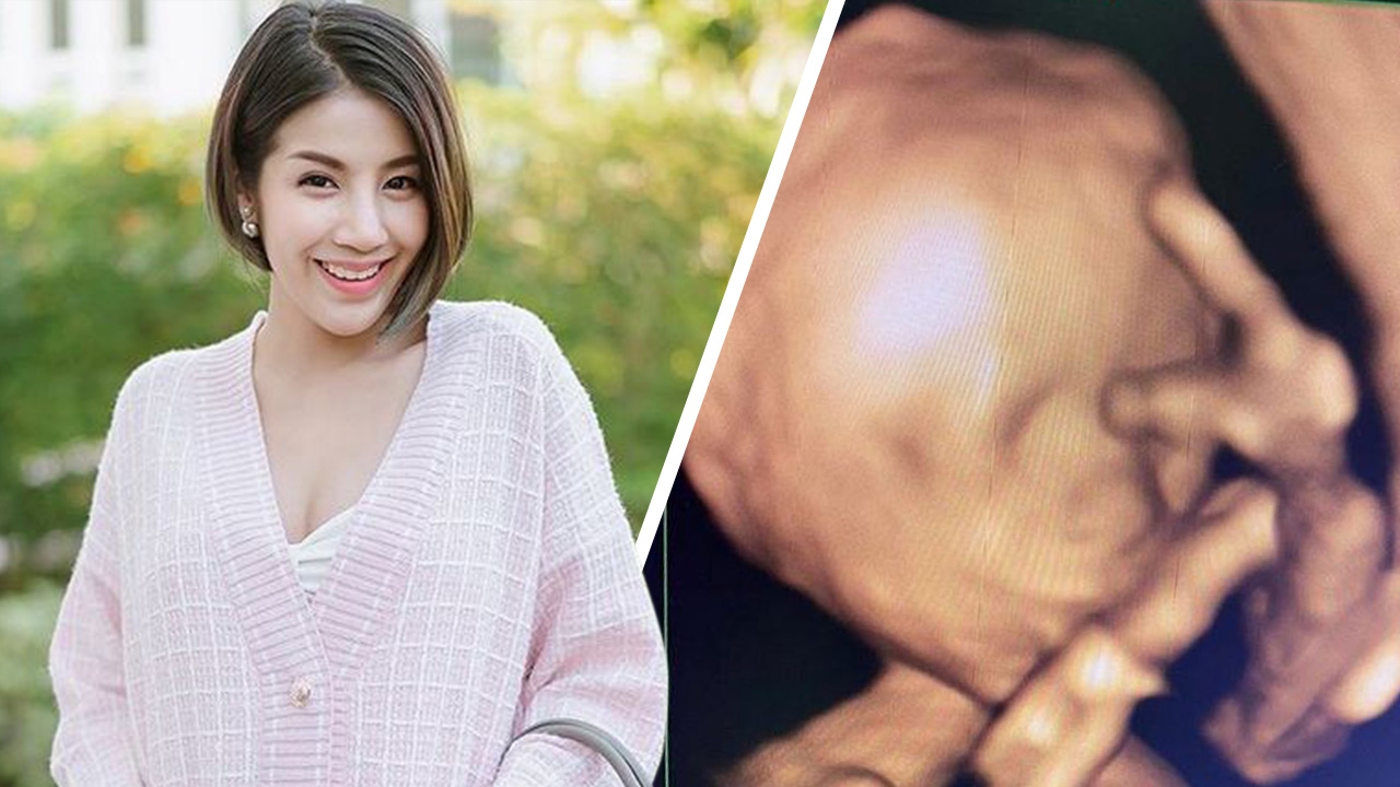 ซุบซิบกับหมวยแซบ : "ใบเตย อาร์สยาม" เผยภาพอัลตราซาวนด์ "น้องเวทมนต์" จมูกโด่งมาแต่ไกล