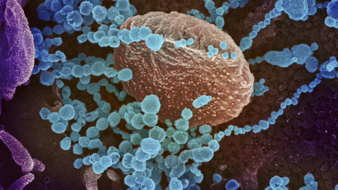 ศ.ดังออสเตรเลียเชื่อ โควิดหลุดจากแล็บอู่ฮั่น ผู้ป่วยหมายเลข0อยู่ที่นี่