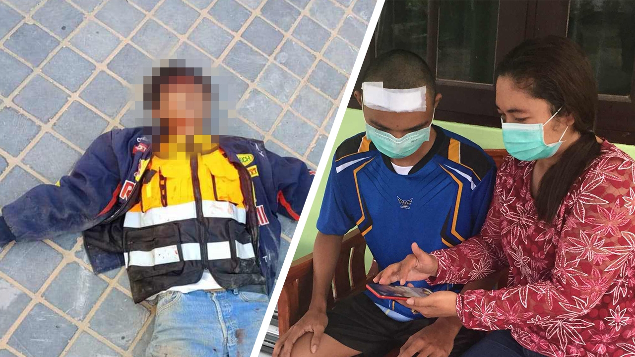 แม่โพสต์ คนเถื่อนทำร้ายลูก 7 รุม 1 โดยไม่รู้จักมาก่อน เจ็บหนักต้องผ่าสมอง